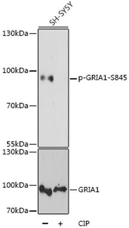 Western blot - Phospho-GRIA1-S845 antibody (AP0825)