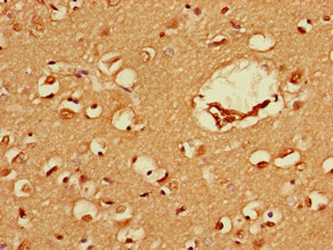 Immunohistochemistry of paraffin-embedded human brain tissue using CSB-PA03389A0Rb at dilution of 1:100