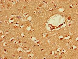 Immunohistochemistry of paraffin-embedded human brain tissue using CSB-PA03389A0Rb at dilution of 1:100