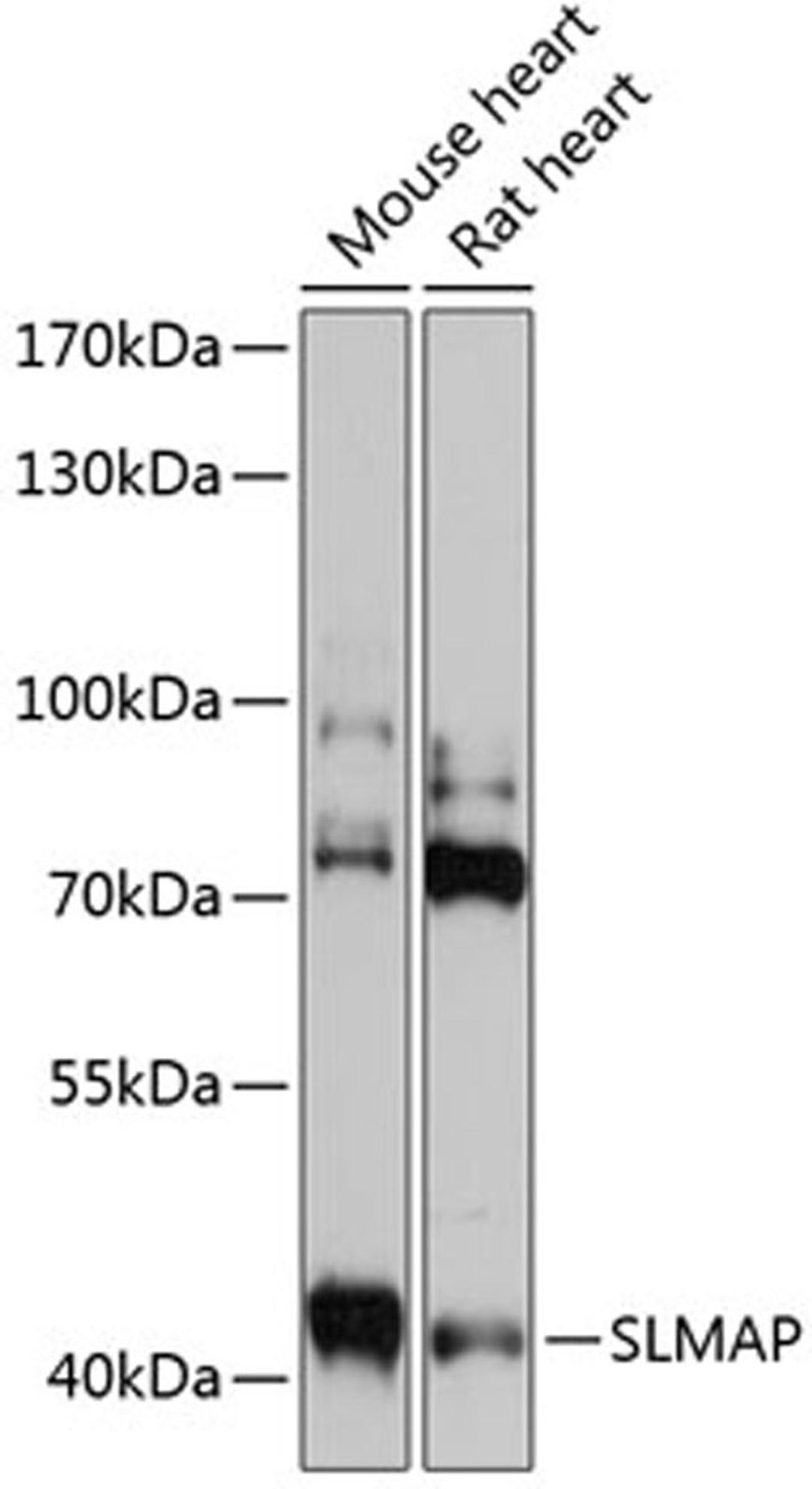 Western blot - SLMAP antibody (A14367)