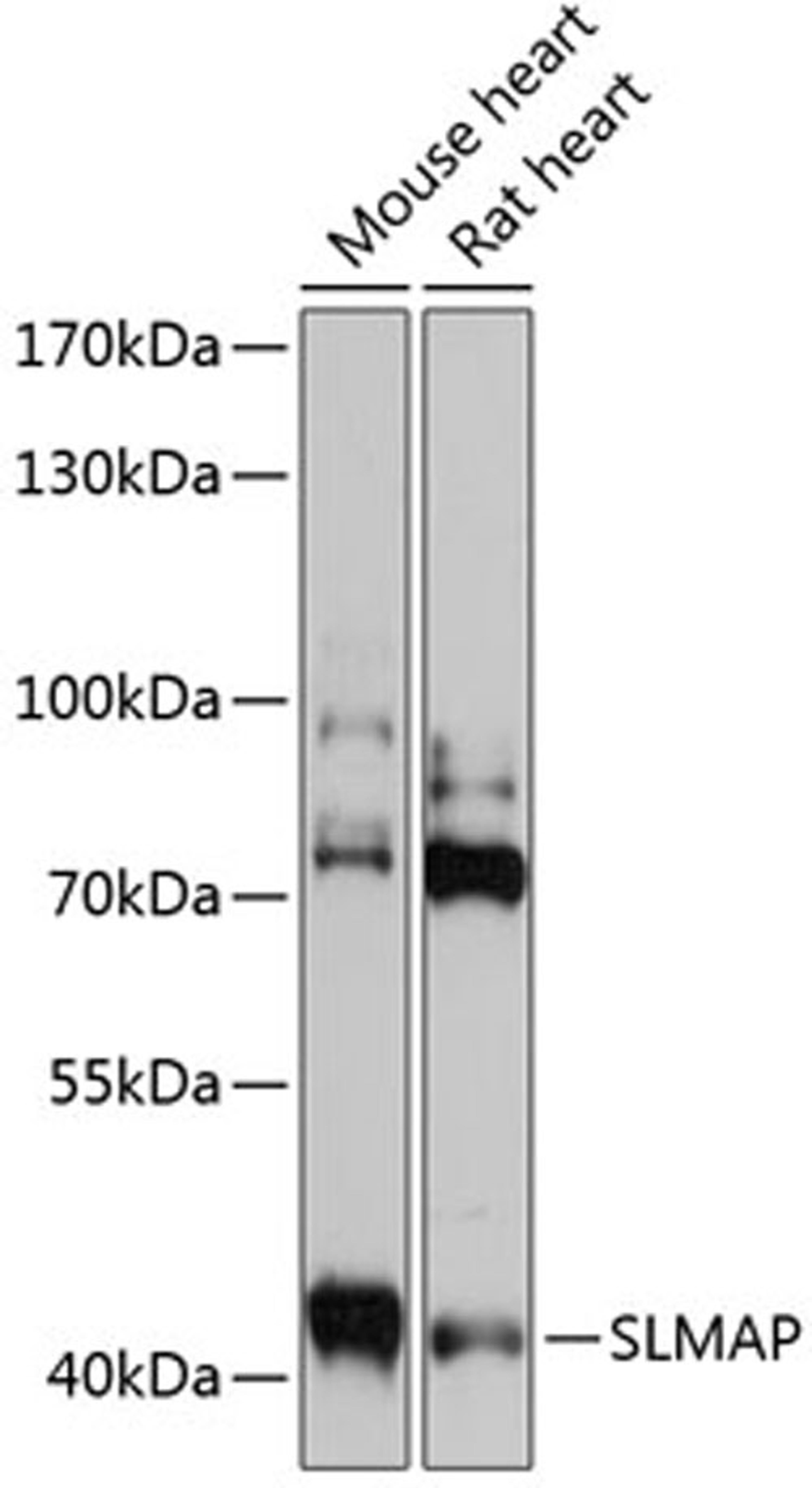 Western blot - SLMAP antibody (A14367)