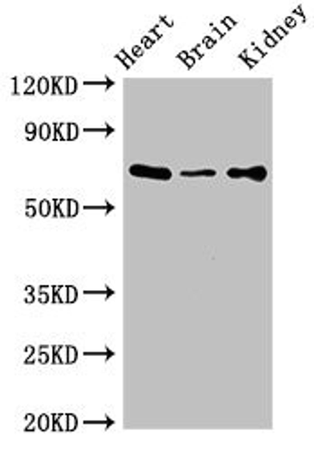 Western Blot. Positive WB detected in: Mouse heart tissue, Mouse brain tissue, Mouse kidney tissue. All lanes: SLC6A13 antibody at 3ug/ml. Secondary. Goat polyclonal to rabbit IgG at 1/50000 dilution. Predicted band size: 69, 58, 11 kDa. Observed band size: 69 kDa. 