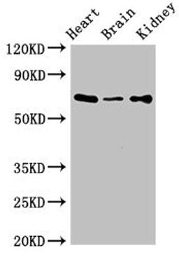 Western Blot. Positive WB detected in: Mouse heart tissue, Mouse brain tissue, Mouse kidney tissue. All lanes: SLC6A13 antibody at 3ug/ml. Secondary. Goat polyclonal to rabbit IgG at 1/50000 dilution. Predicted band size: 69, 58, 11 kDa. Observed band size: 69 kDa. 