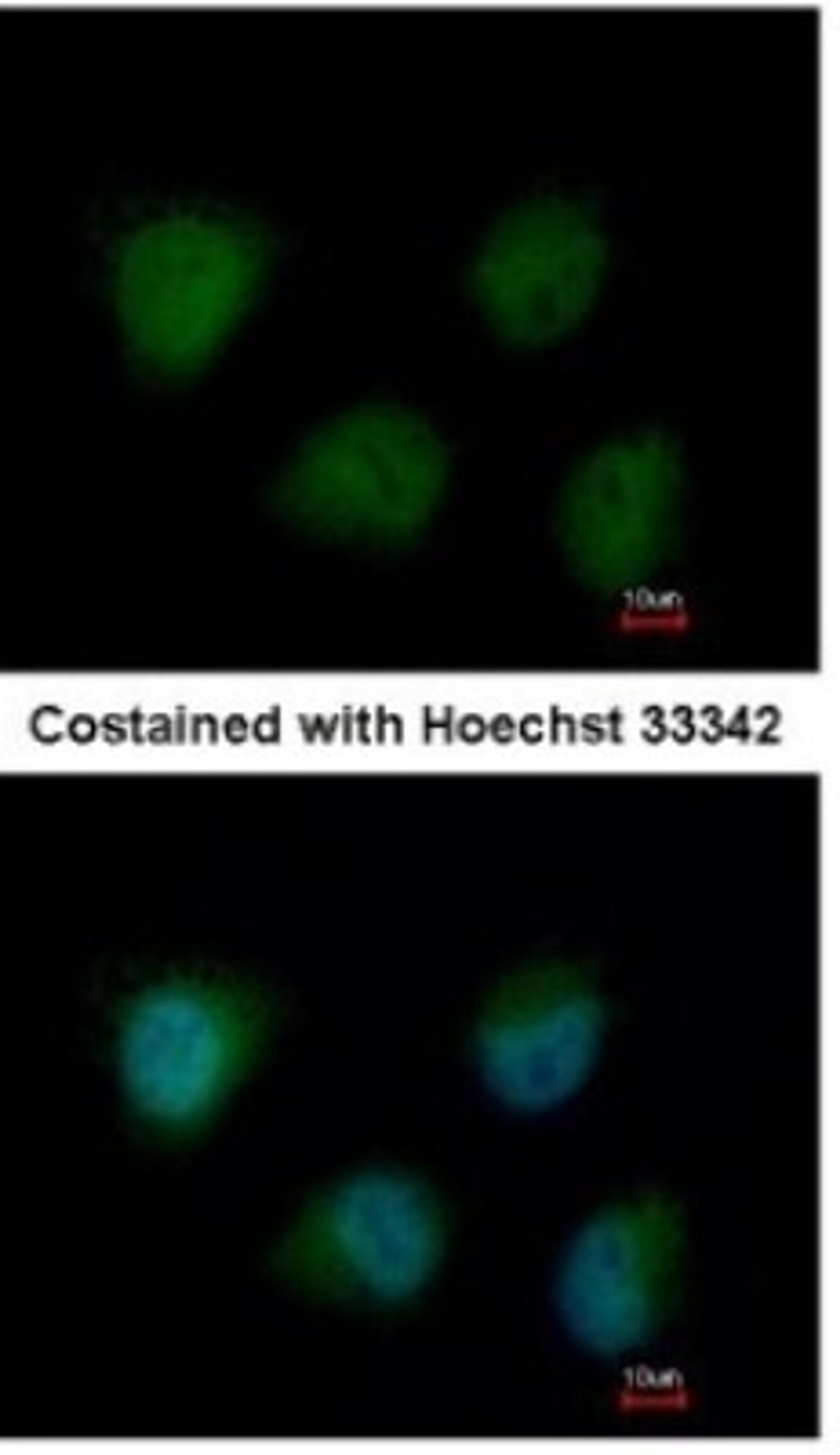 Immunocytochemistry/Immunofluorescence: O-GlcNAc Transferase p110 subunit Antibody [NBP1-32791] - Paraformaldehyde-fixed HeLa, using antibody at 1:200 dilution.