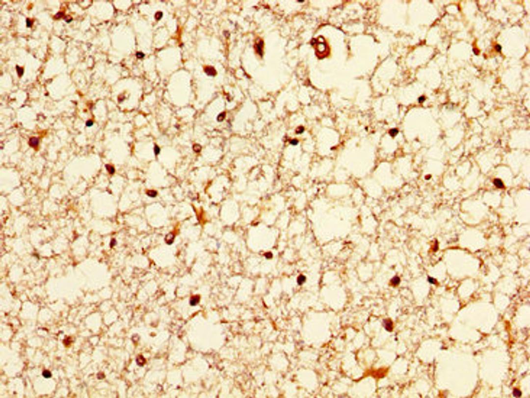 IHC image of CSB-PA850841LA01HU diluted at 1:200 and staining in paraffin-embedded human brain tissue performed on a Leica BondTM system. After dewaxing and hydration, antigen retrieval was mediated by high pressure in a citrate buffer (pH 6.0). Section was blocked with 10% normal goat serum 30min at RT. Then primary antibody (1% BSA) was incubated at 4°C overnight. The primary is detected by a biotinylated secondary antibody and visualized using an HRP conjugated SP system.