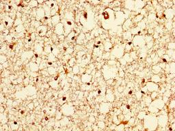 IHC image of CSB-PA850841LA01HU diluted at 1:200 and staining in paraffin-embedded human brain tissue performed on a Leica BondTM system. After dewaxing and hydration, antigen retrieval was mediated by high pressure in a citrate buffer (pH 6.0). Section was blocked with 10% normal goat serum 30min at RT. Then primary antibody (1% BSA) was incubated at 4°C overnight. The primary is detected by a biotinylated secondary antibody and visualized using an HRP conjugated SP system.