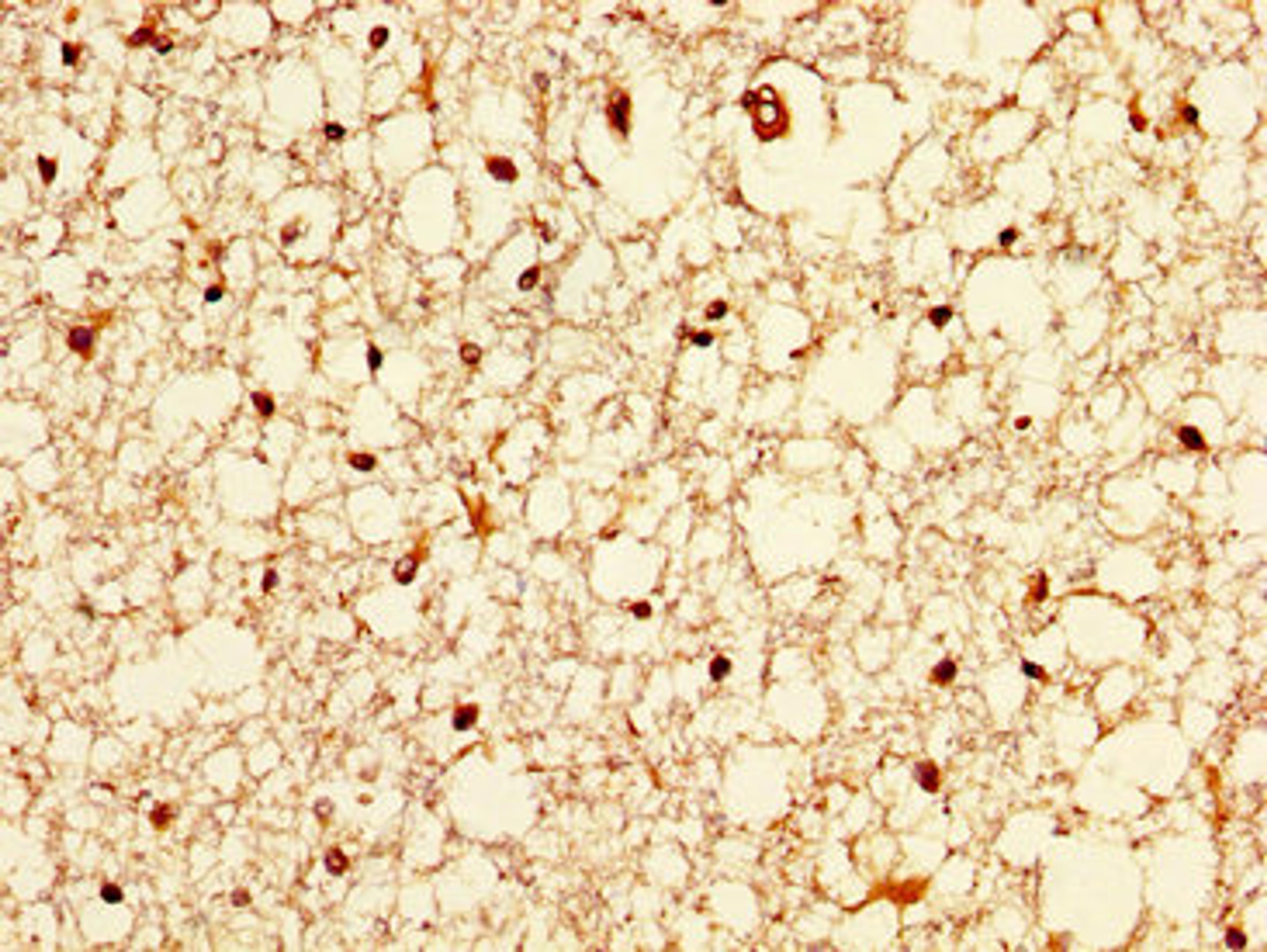 IHC image of CSB-PA850841LA01HU diluted at 1:200 and staining in paraffin-embedded human brain tissue performed on a Leica BondTM system. After dewaxing and hydration, antigen retrieval was mediated by high pressure in a citrate buffer (pH 6.0). Section was blocked with 10% normal goat serum 30min at RT. Then primary antibody (1% BSA) was incubated at 4°C overnight. The primary is detected by a biotinylated secondary antibody and visualized using an HRP conjugated SP system.