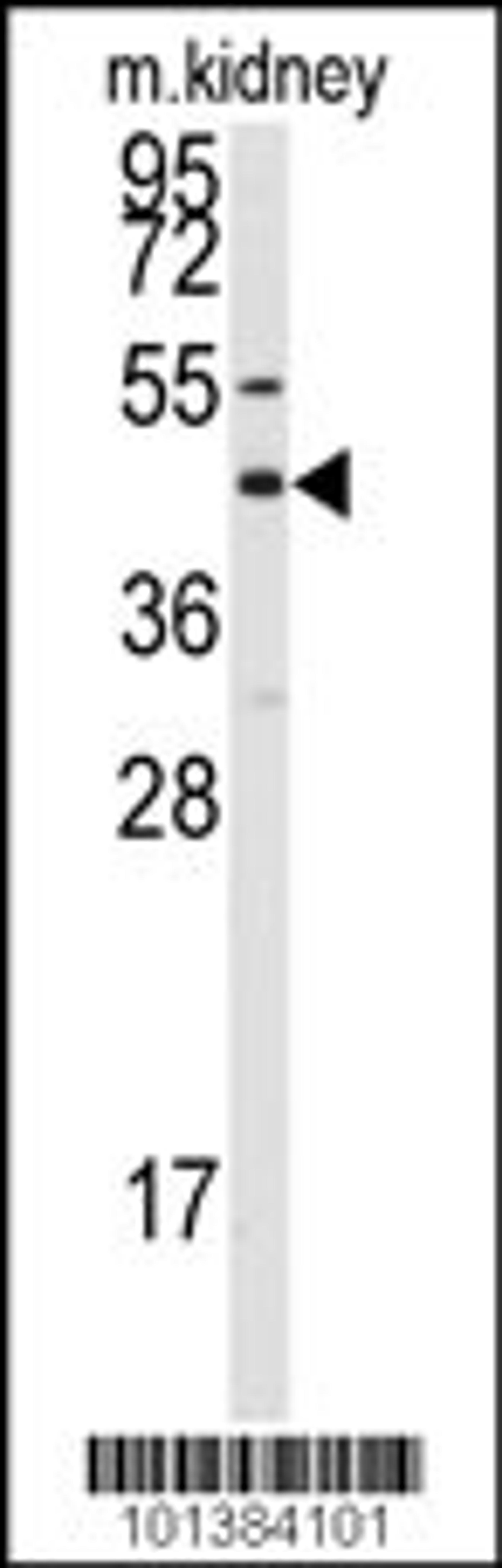 Western blot analysis of anti-GJA8 Antibody in mouse kidney tissue lysates (35ug/lane)