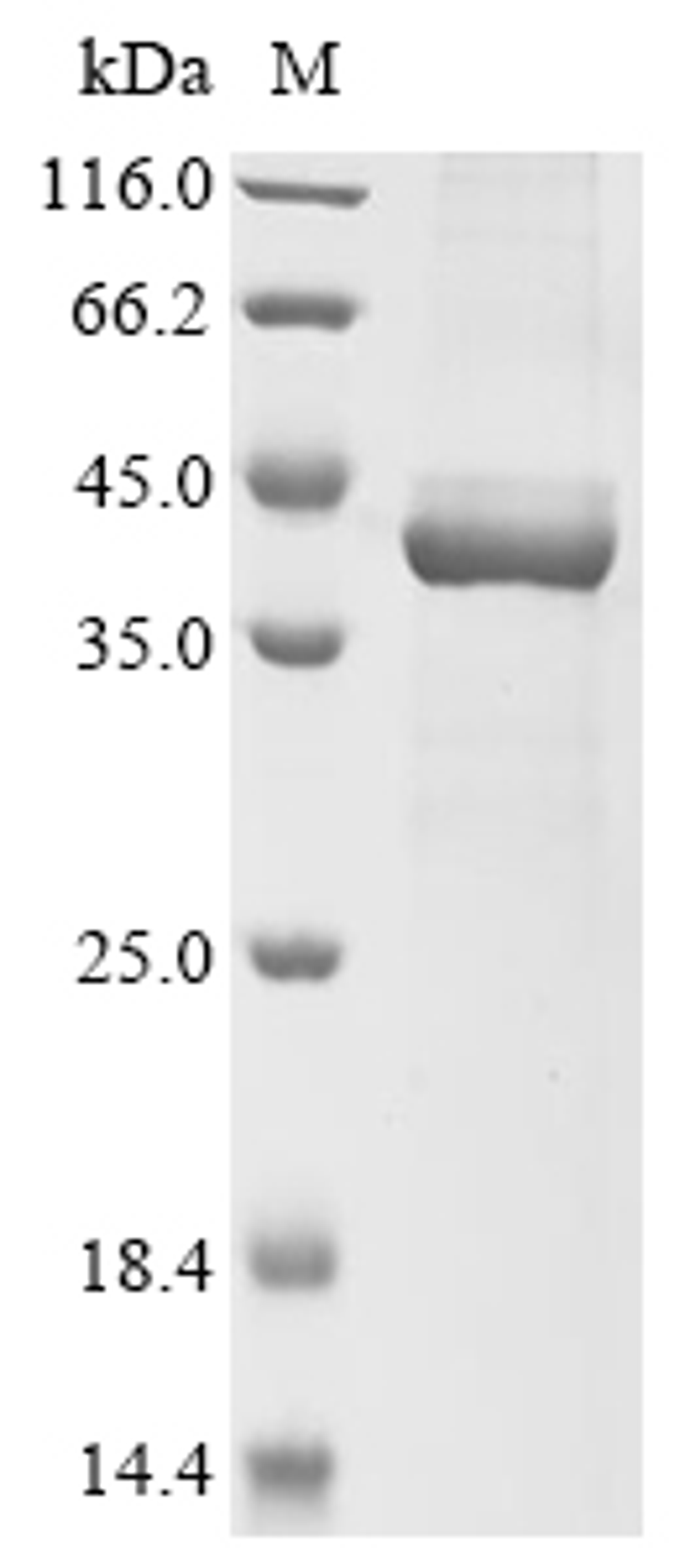 (Tris-Glycine gel) Discontinuous SDS-PAGE (reduced) with 5% enrichment gel and 15% separation gel.