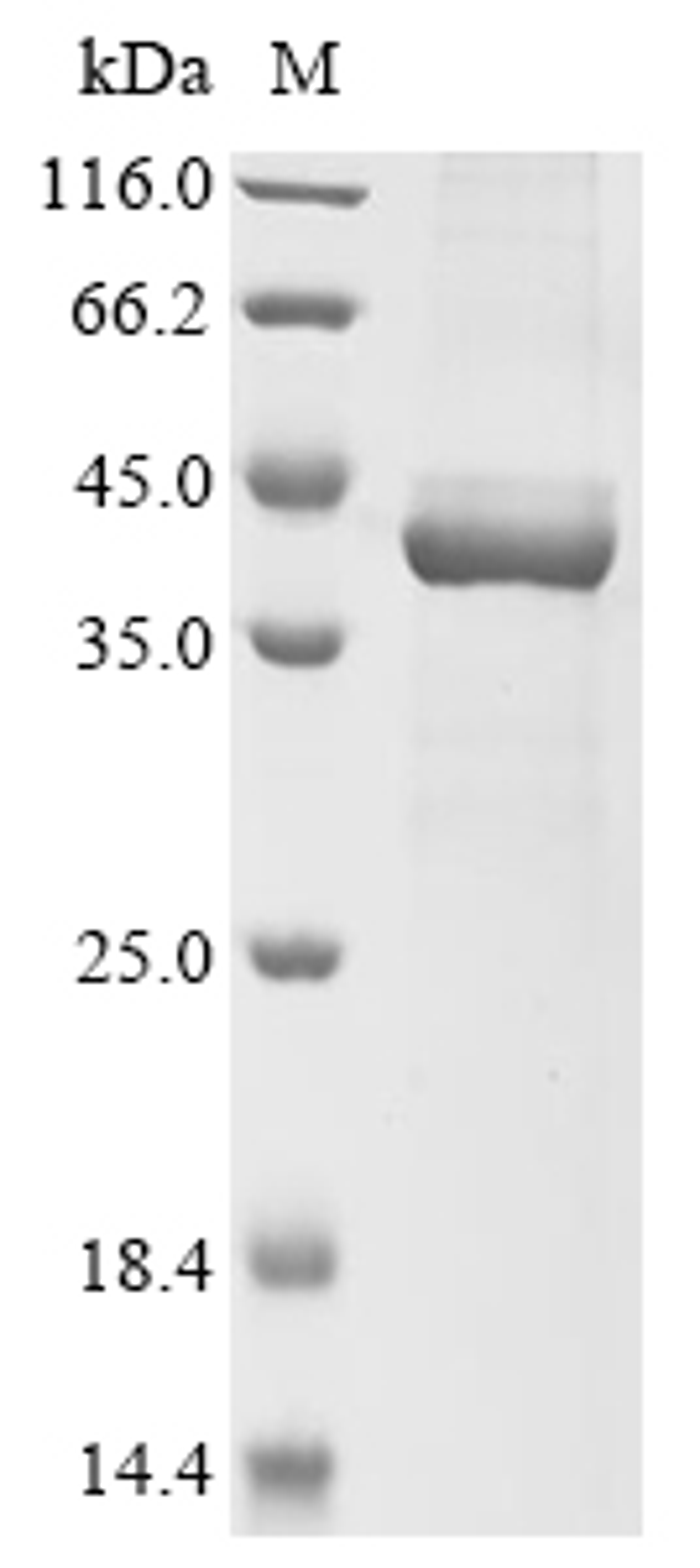 (Tris-Glycine gel) Discontinuous SDS-PAGE (reduced) with 5% enrichment gel and 15% separation gel.