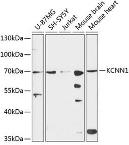 Western blot - KCNN1 antibody (A9322)