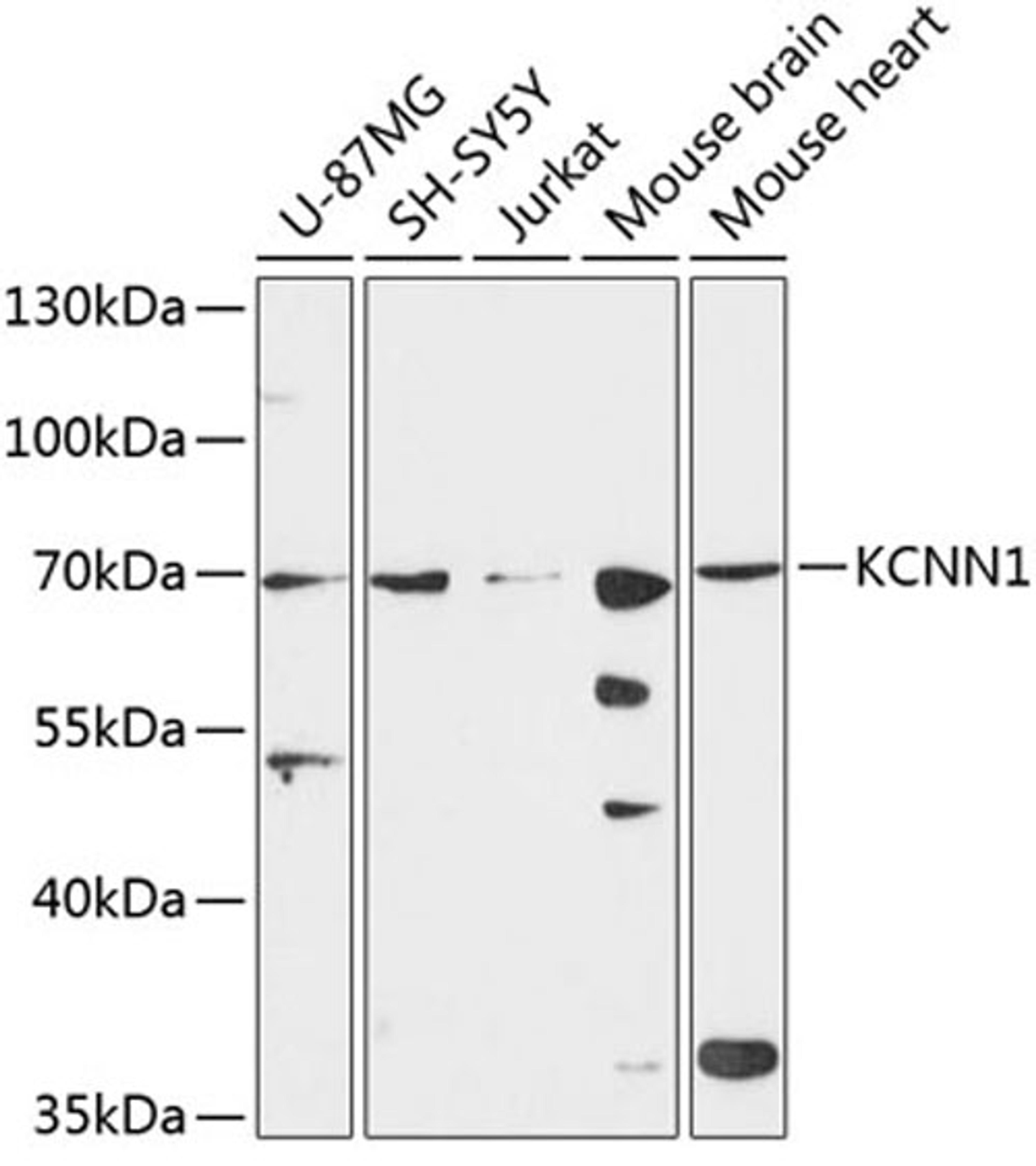 Western blot - KCNN1 antibody (A9322)