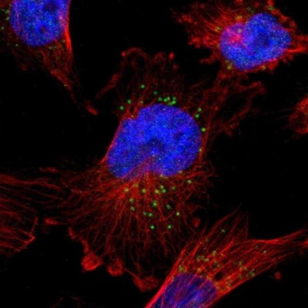 Immunocytochemistry/Immunofluorescence: hydroxysteroid (17-beta) dehydrogenase 11 Antibody [NBP1-90334] - Staining of human cell line U-251MG shows positivity in vesicles.