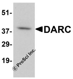 Western blot analysis of DARC in human cerebellum tissue lysate with DARC antibody at 1 &#956;g/mL.