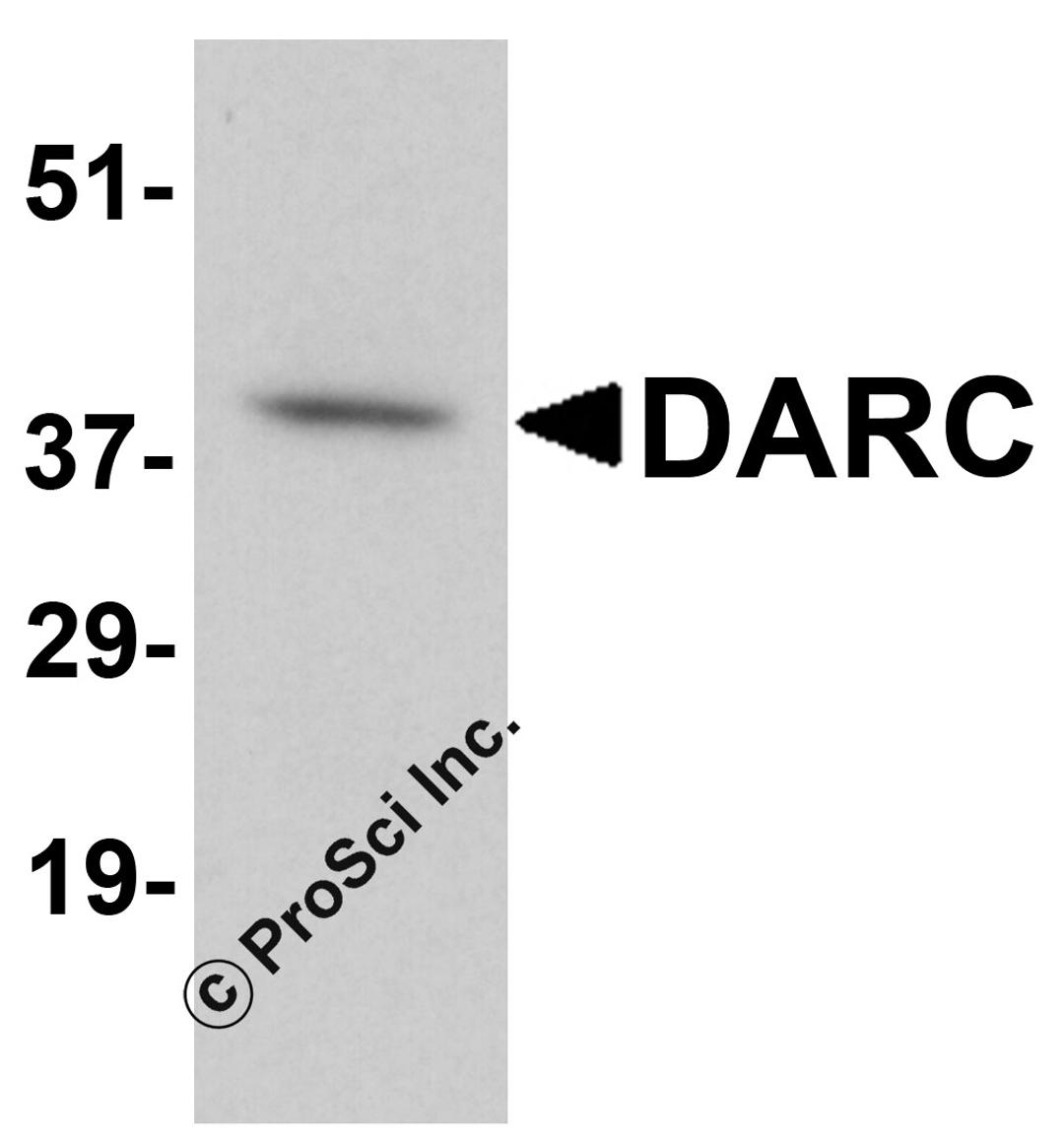 Western blot analysis of DARC in human cerebellum tissue lysate with DARC antibody at 1 μg/mL.