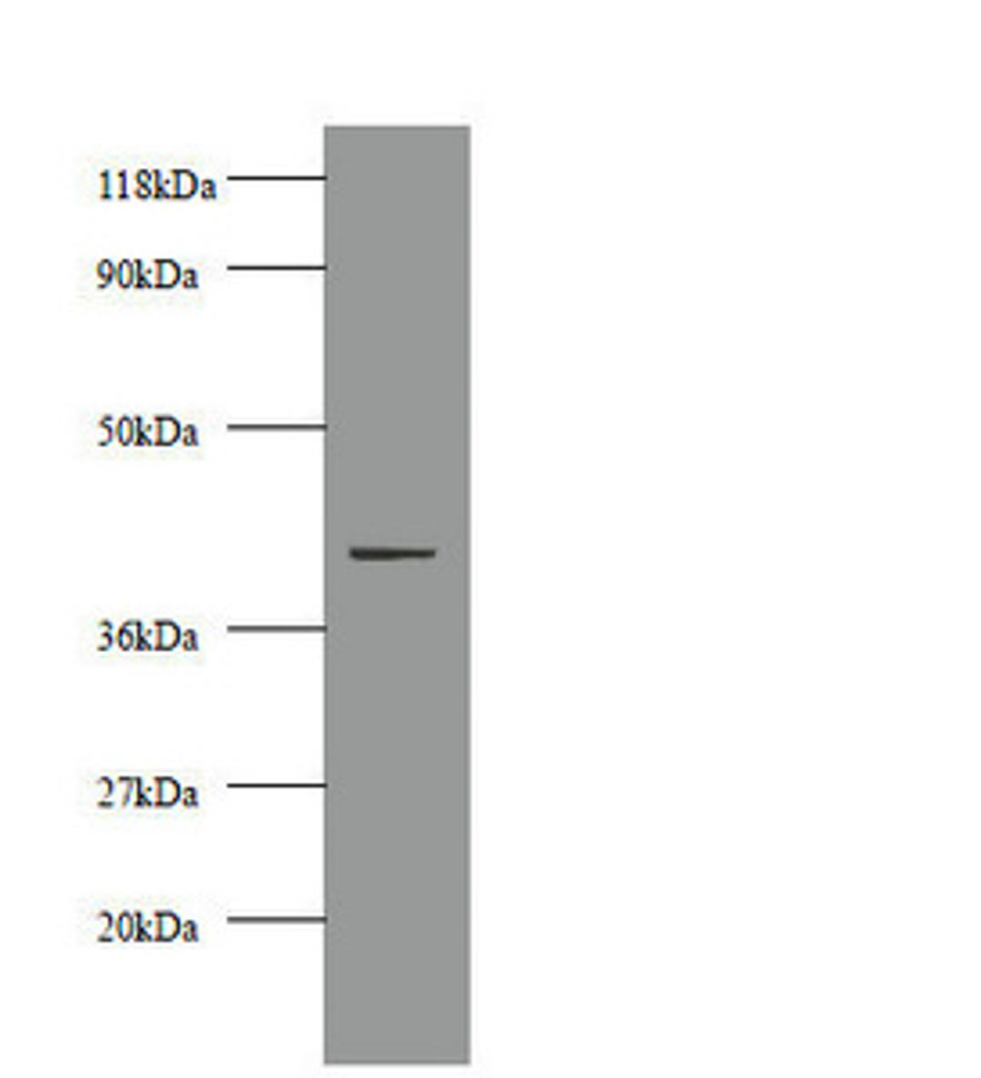 Western blot. All lanes: Creatine kinase M-type antibody at 2µg/ml + 293T whole cell lysate. Secondary. Goat polyclonal to rabbit IgG at 1/10000 dilution. Predicted band size: 44 kDa. Observed band size: 44 kDa