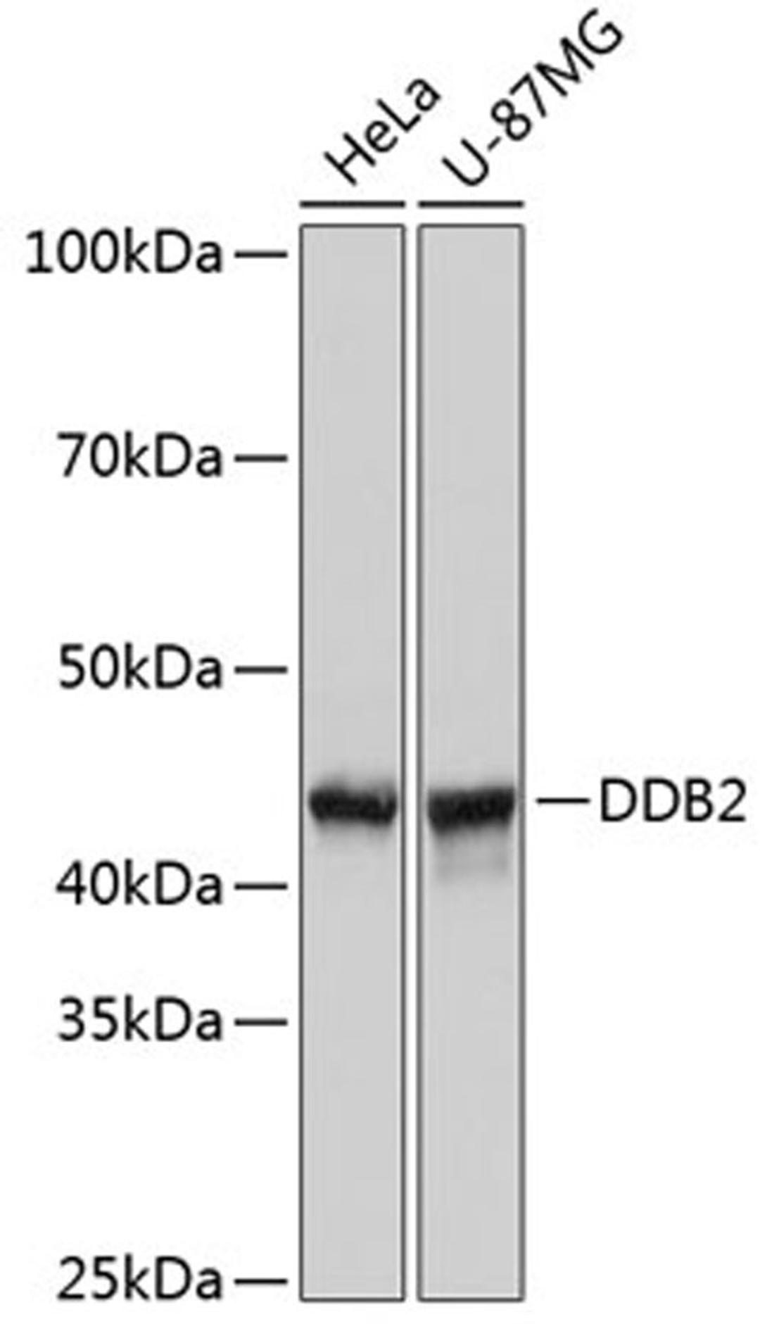 Western blot - DDB2 Rabbit mAb (A11615)