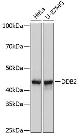 Western blot - DDB2 Rabbit mAb (A11615)