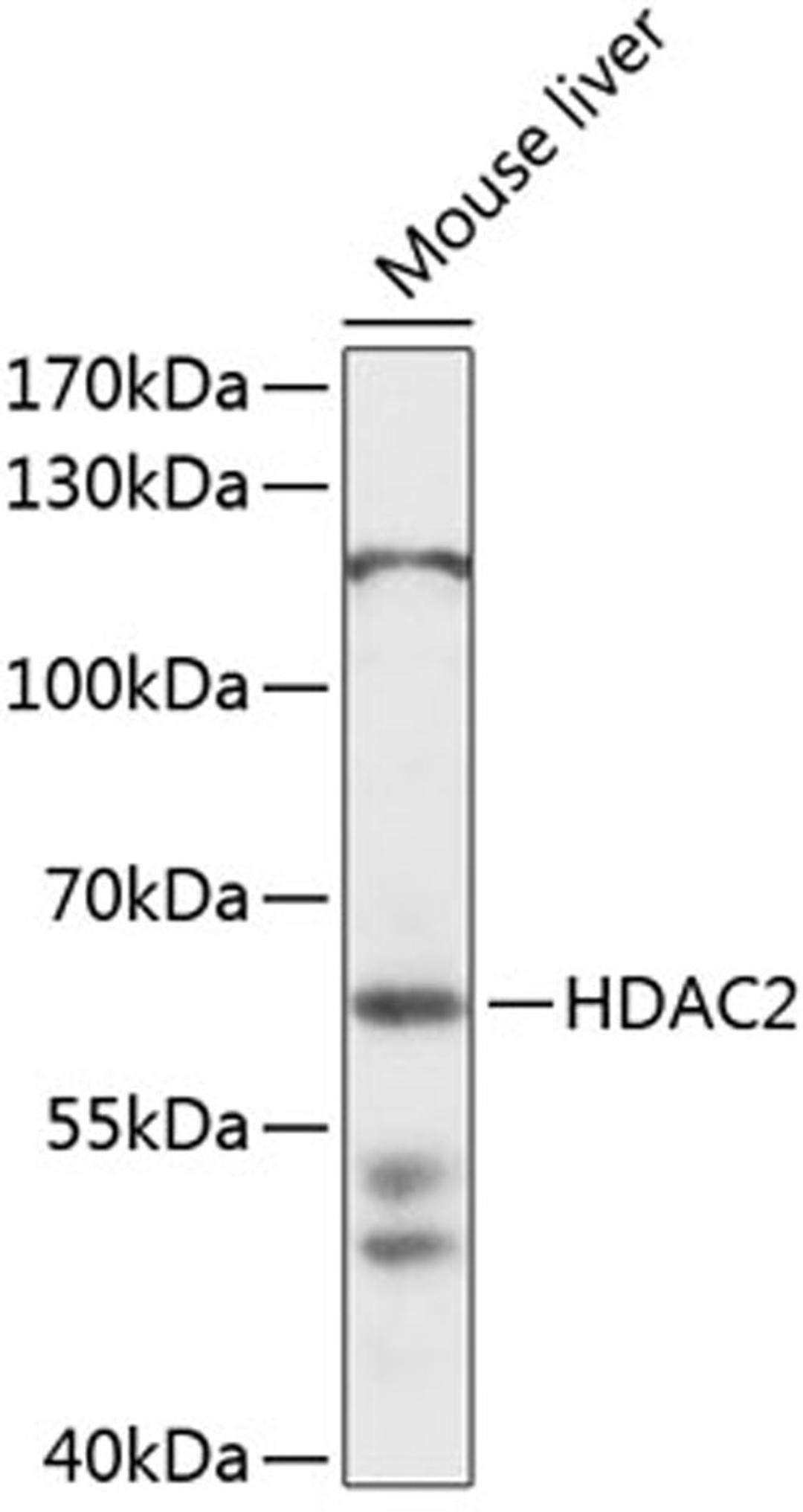 Western blot - HDAC2 antibody (A13618)