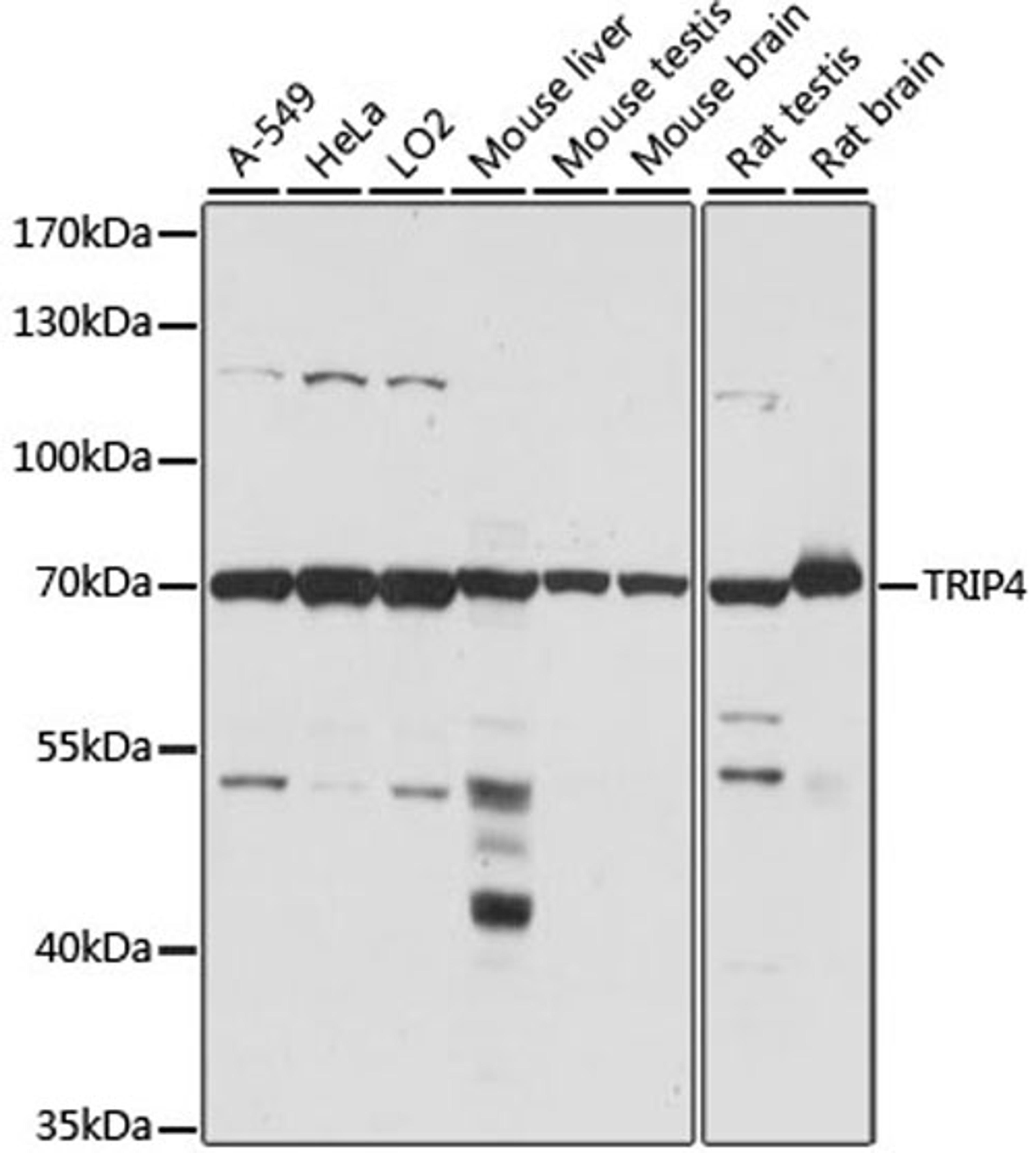 Western blot - TRIP4 antibody (A15352)