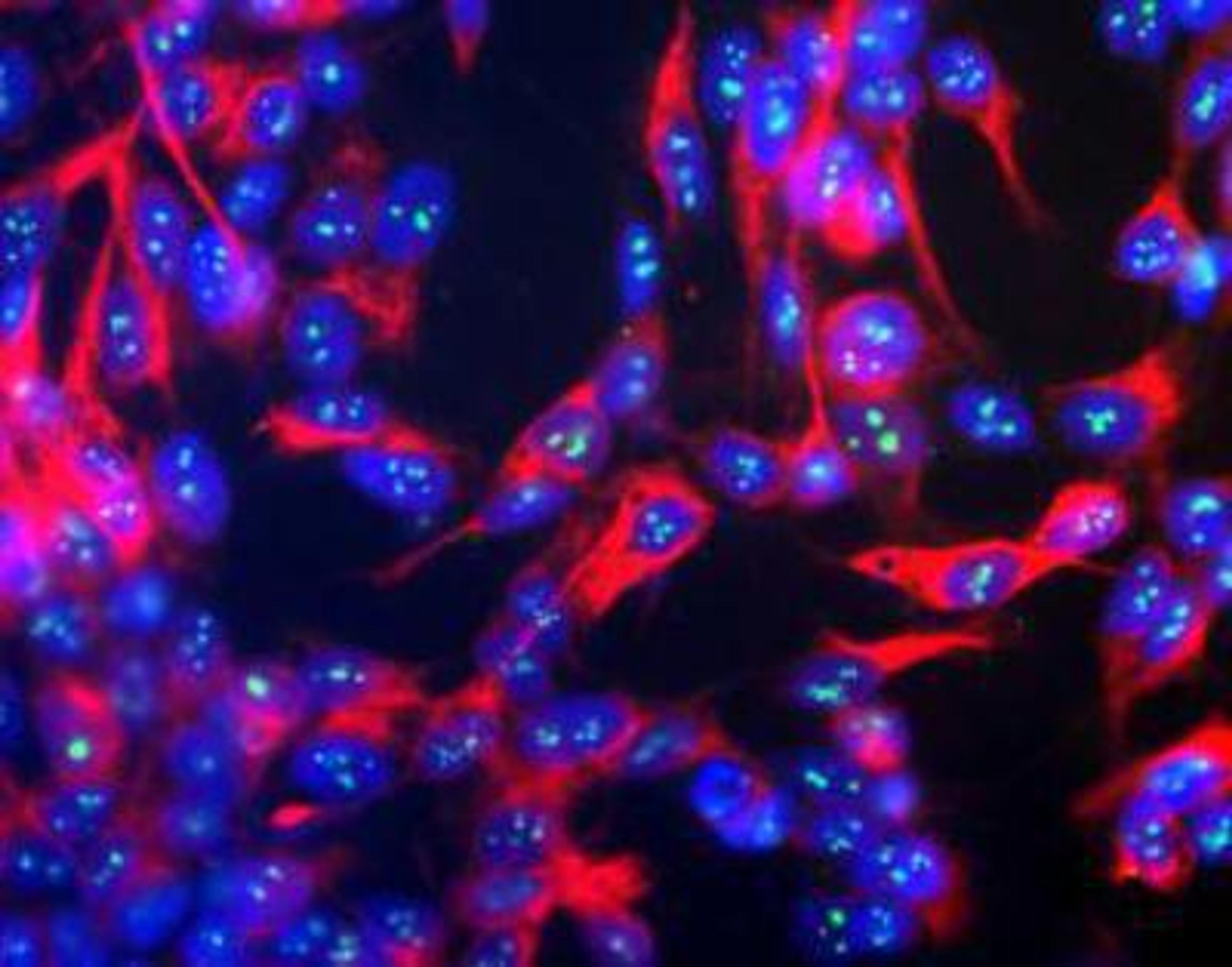 Immunocytochemistry/Immunofluorescence: Fibrillarin Antibody (38F3) [NB300-269] - Human SH-SY5Y cells stained with NB300-269, showing prominent specular nucleolar staining. The nuclei are counter stained with DAPI (blue), so these spots appear very pale blue.  Neurofilament heavy protein was stained with NB300-217 (red).