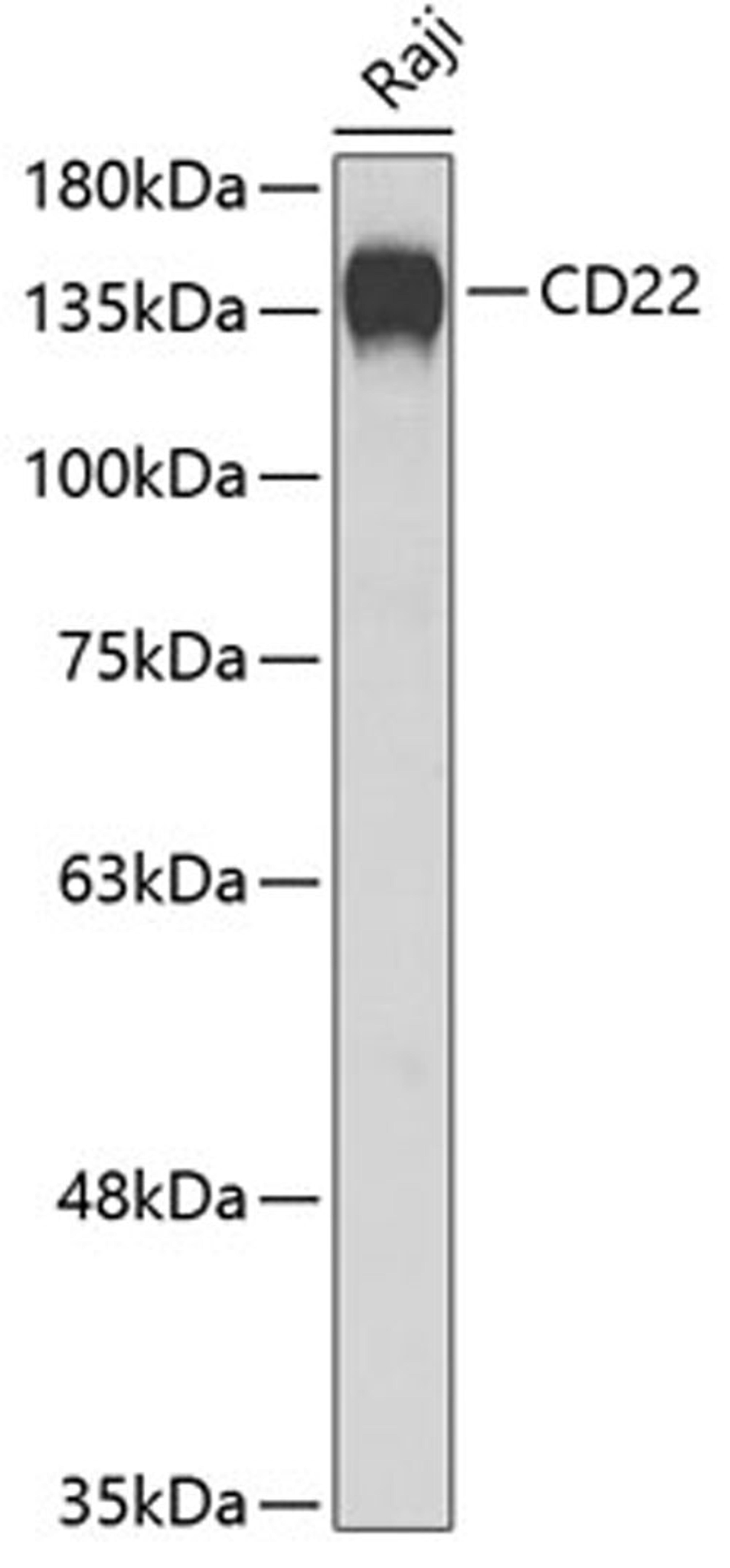 Western blot - CD22 Antibody (A5790)