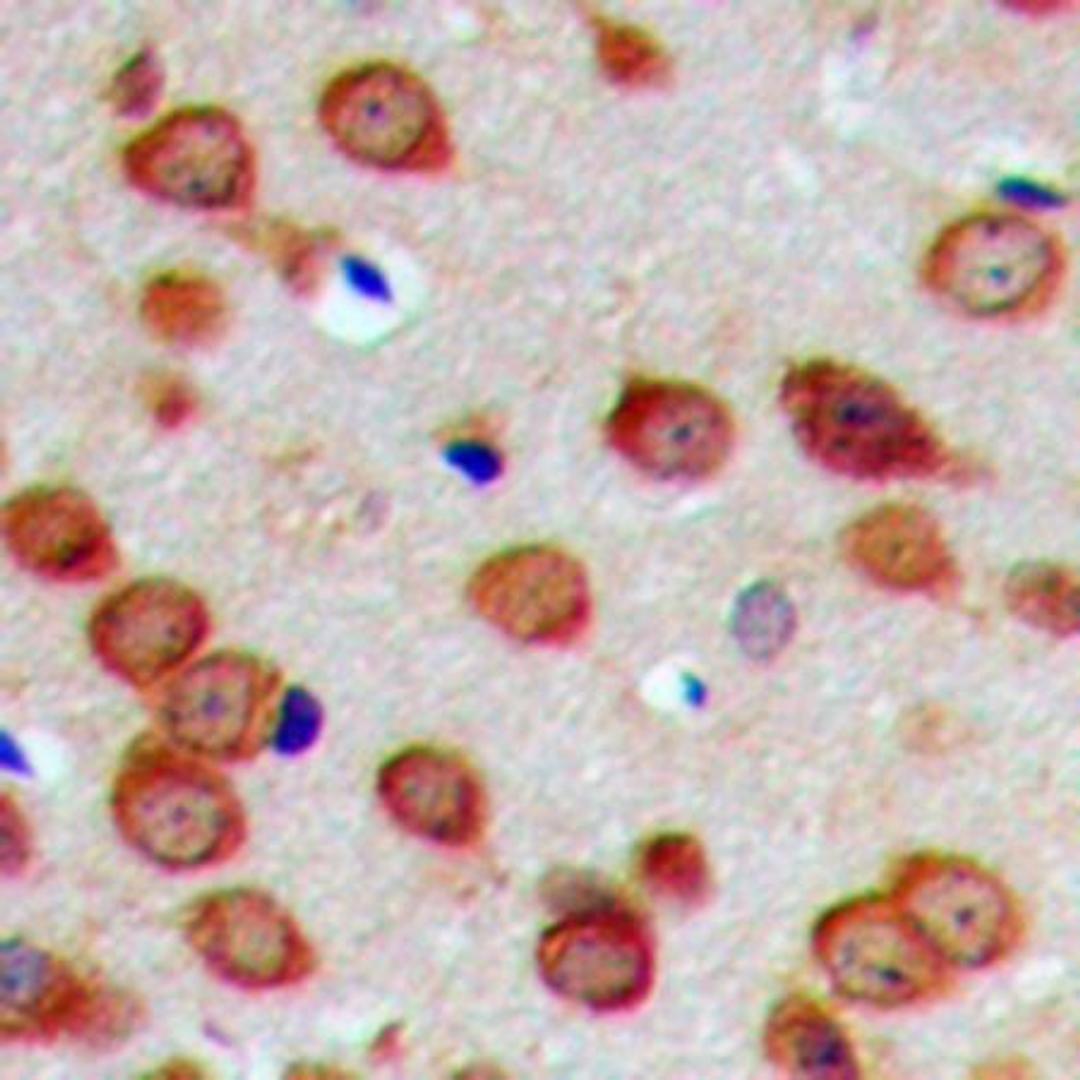 Immunohistochemical analysis of formalin-fixed and paraffin-embedded human brain tissue using DHAPAT antibody