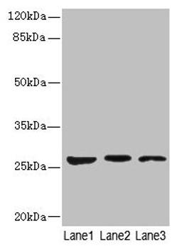 Western blot. All lanes: KLK6 antibody at 5µg/ml. Lane 1: Mouse liver tissue. Lane 2: Mouse brain tissue. Lane 3: A375 whole cell lysate. Secondary. Goat polyclonal to rabbit IgG at 1/10000 dilution. Predicted band size: 27, 16, 5 kDa. Observed band size: 27 kDa