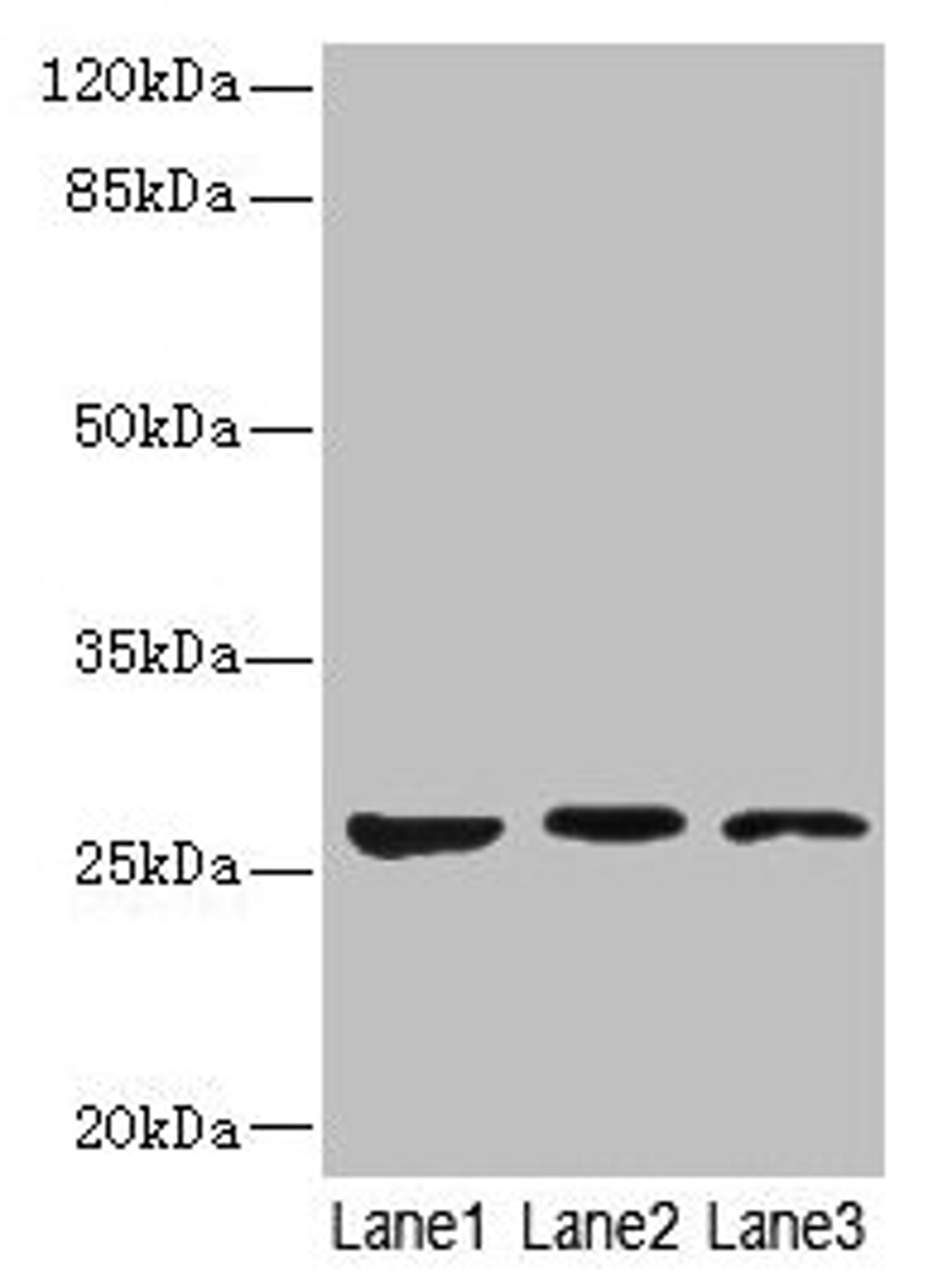Western blot. All lanes: KLK6 antibody at 5µg/ml. Lane 1: Mouse liver tissue. Lane 2: Mouse brain tissue. Lane 3: A375 whole cell lysate. Secondary. Goat polyclonal to rabbit IgG at 1/10000 dilution. Predicted band size: 27, 16, 5 kDa. Observed band size: 27 kDa