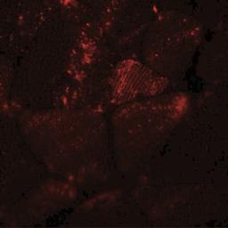 Immunofluorescence: MYH8 Antibody [NBP2-41309] - Mouse skeletal muscle tissue with MYH8 antibody at 20 ug/ml.