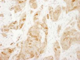 Detection of human RPS6 by immunohistochemistry.