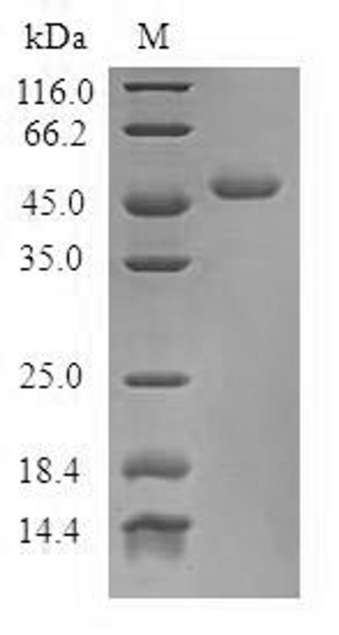 (Tris-Glycine gel) Discontinuous SDS-PAGE (reduced) with 5% enrichment gel and 15% separation gel.