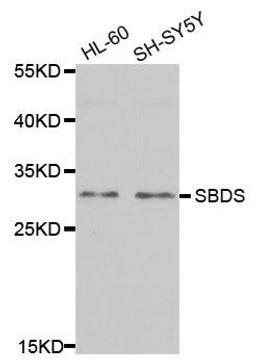 Western blot analysis of extracts of various cell lines using SBDS antibody