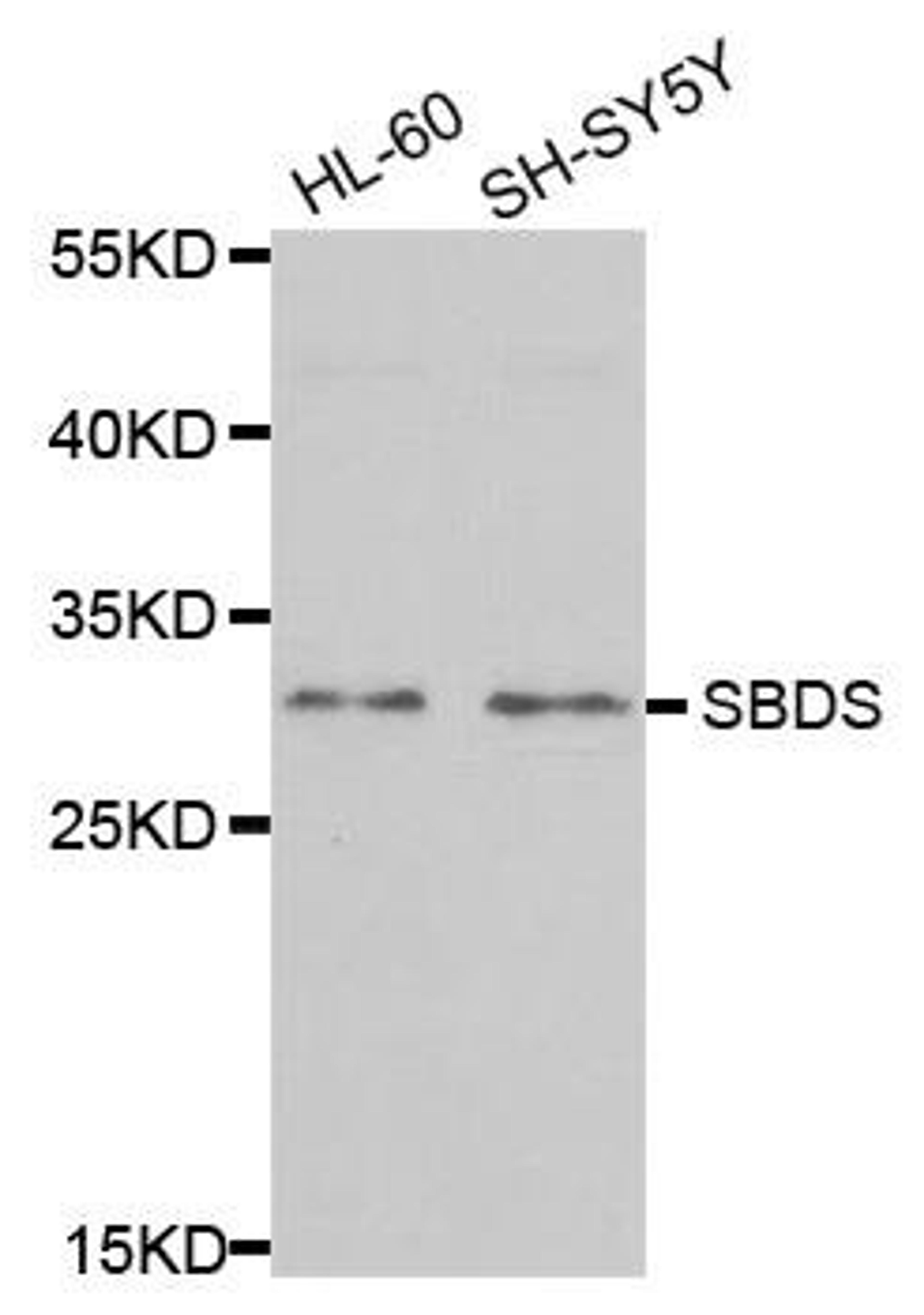 Western blot analysis of extracts of various cell lines using SBDS antibody