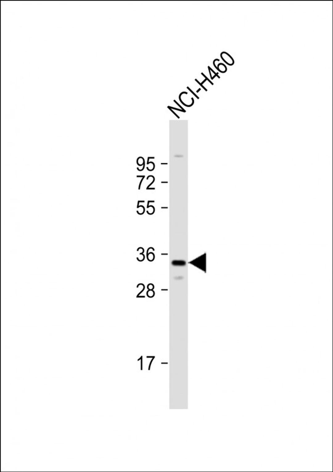 Western Blot at 1:1000 dilution + NCI-H460 whole cell lysate Lysates/proteins at 20 ug per lane.