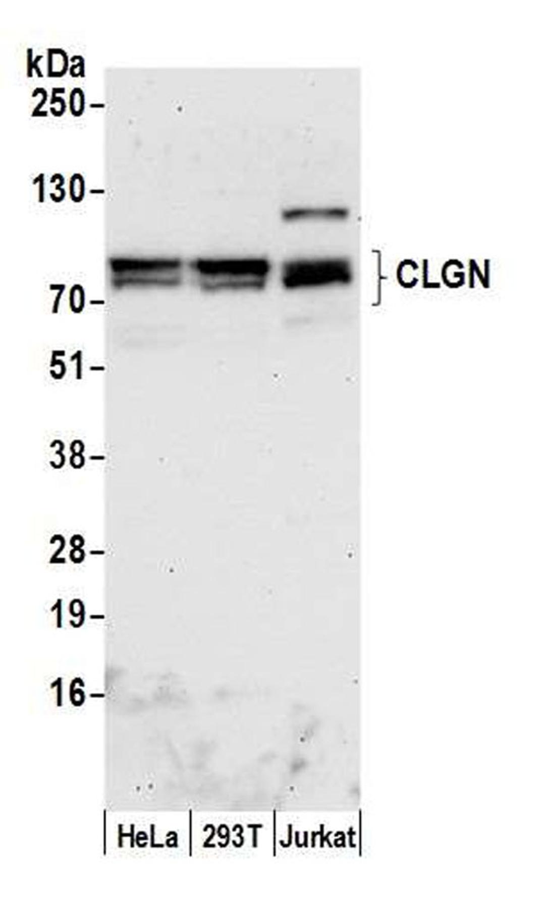 Detection of human CLGN by WB.