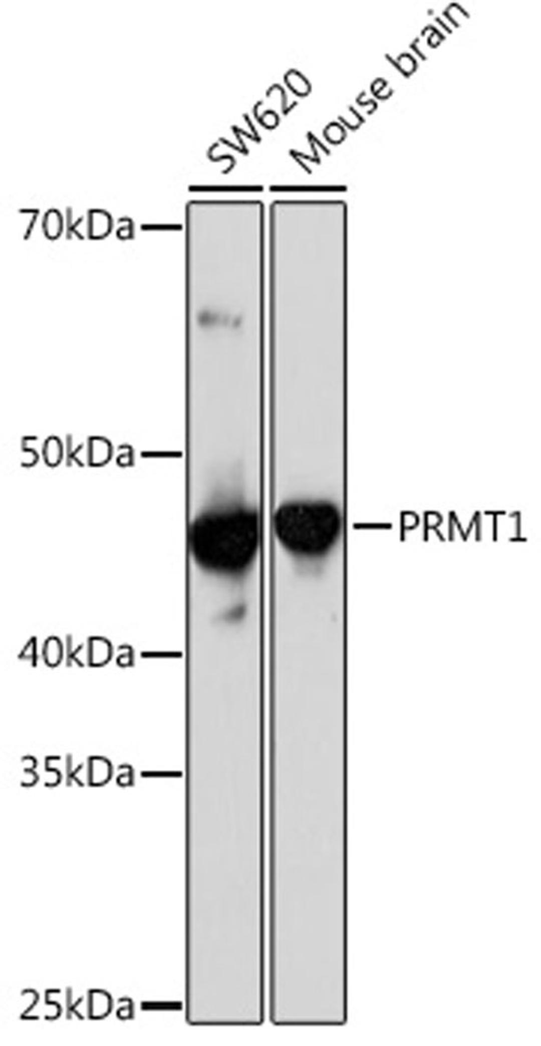 Western blot - PRMT1 Rabbit mAb (A4502)