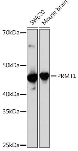 Western blot - PRMT1 Rabbit mAb (A4502)