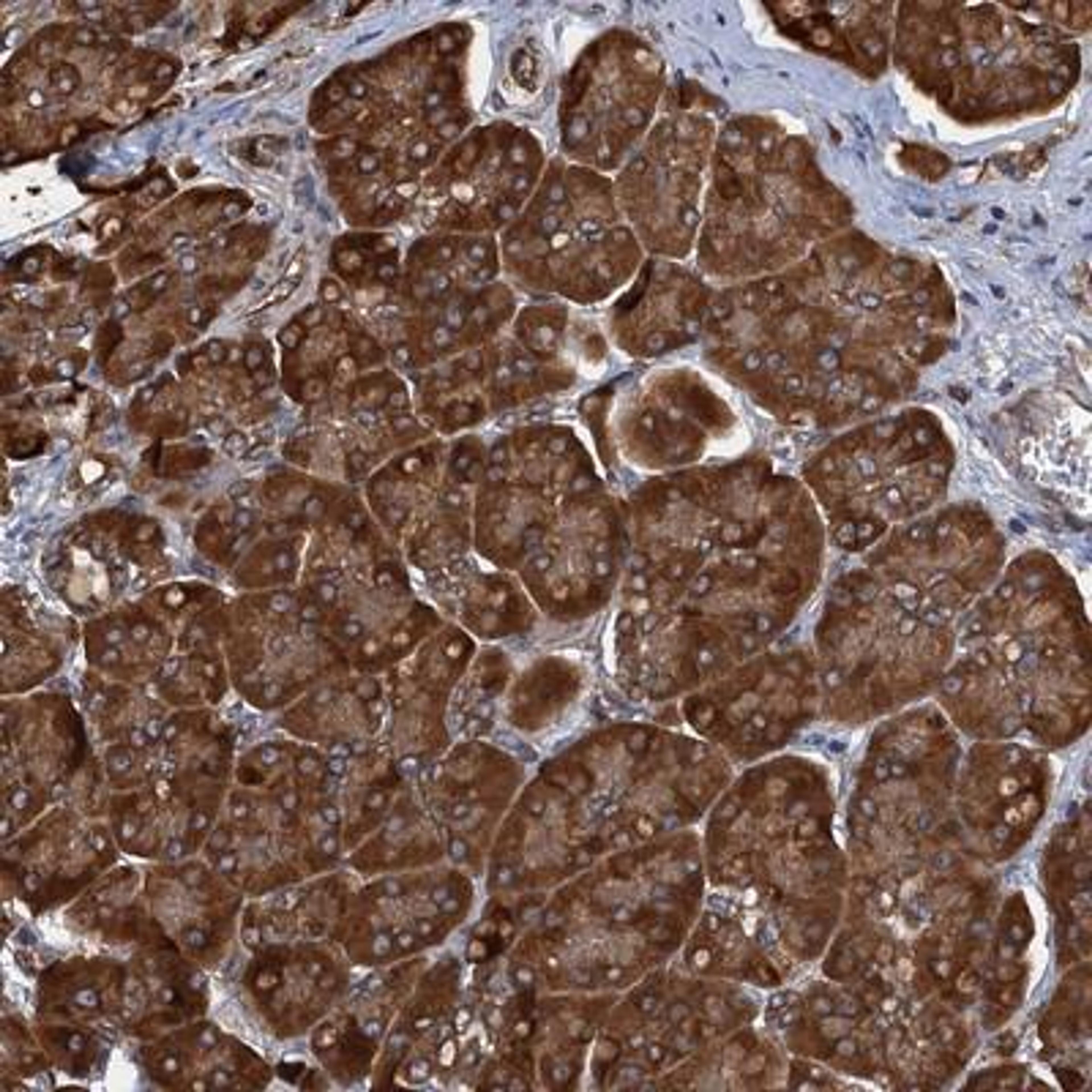 Immunohistochemistry: ARMC5 Antibody [NBP1-94024] - Staining of human pancreas shows strong cytoplasmic positivity in exocrine pancreas.