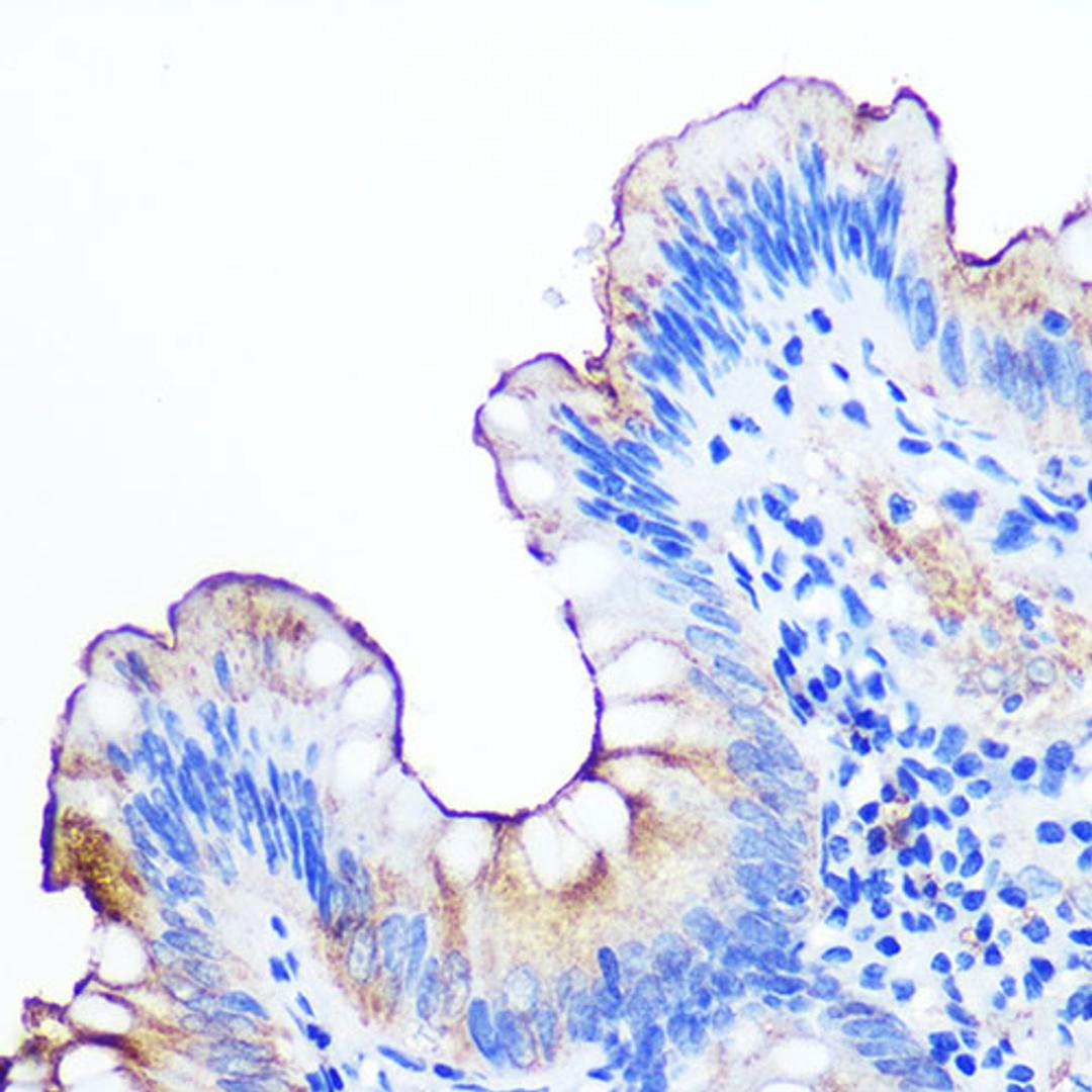 Immunohistochemistry  - CEACAM1 Rabbit mAb (A11626)