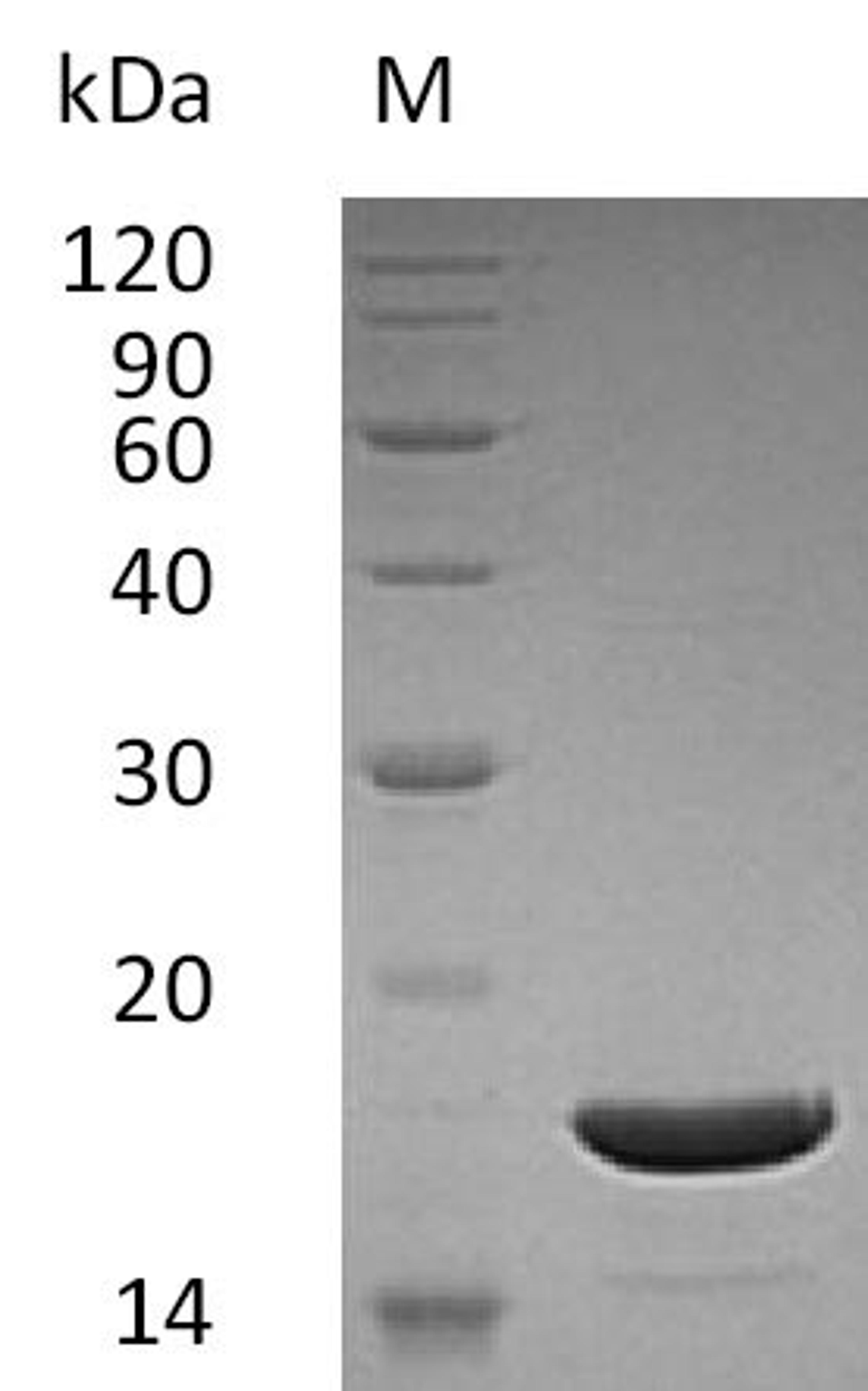 (Tris-Glycine gel) Discontinuous SDS-PAGE (reduced) with 5% enrichment gel and 15% separation gel.