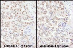 Detection of human ADAR1 by immunohistochemistry.