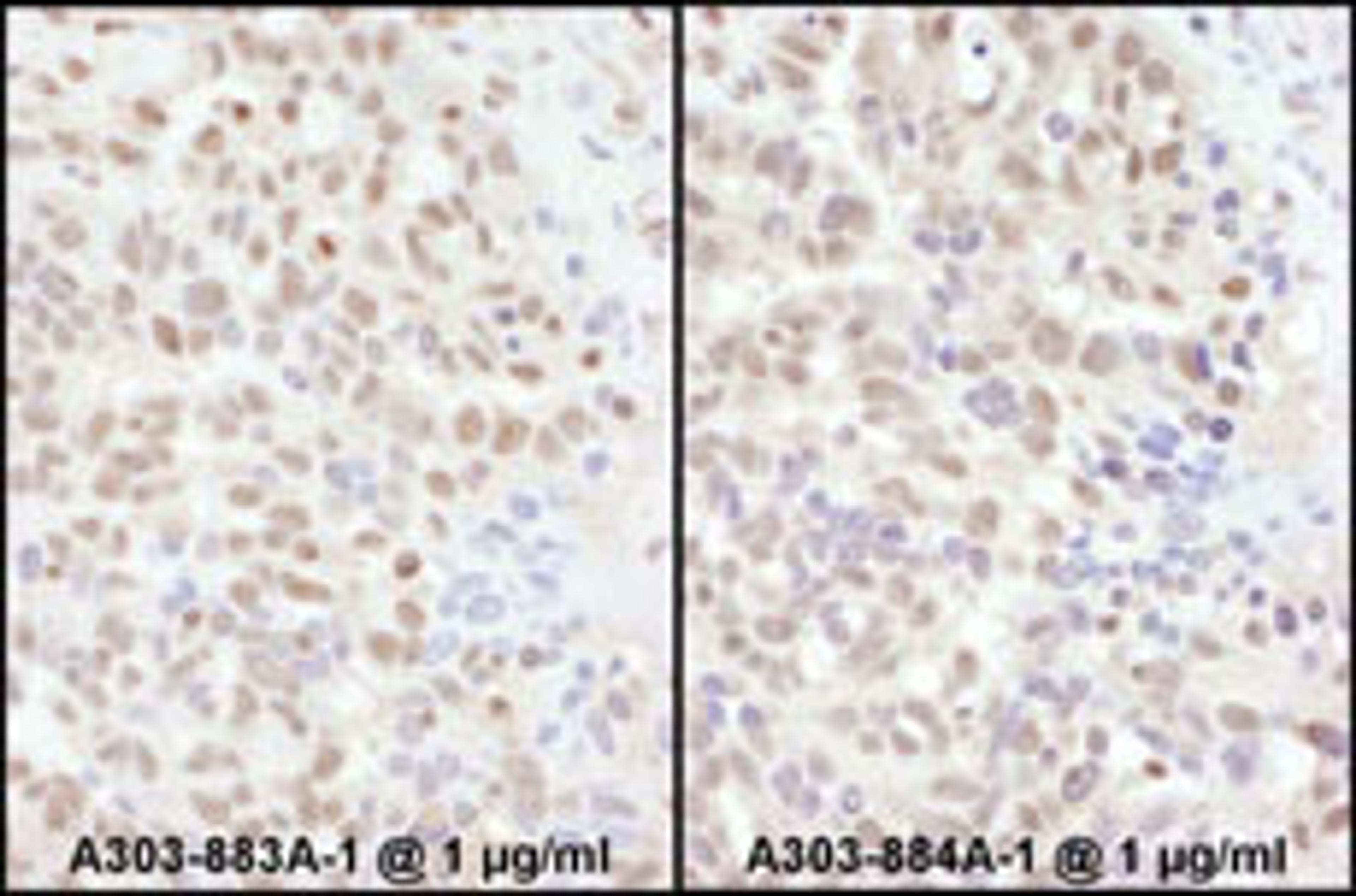 Detection of human ADAR1 by immunohistochemistry.