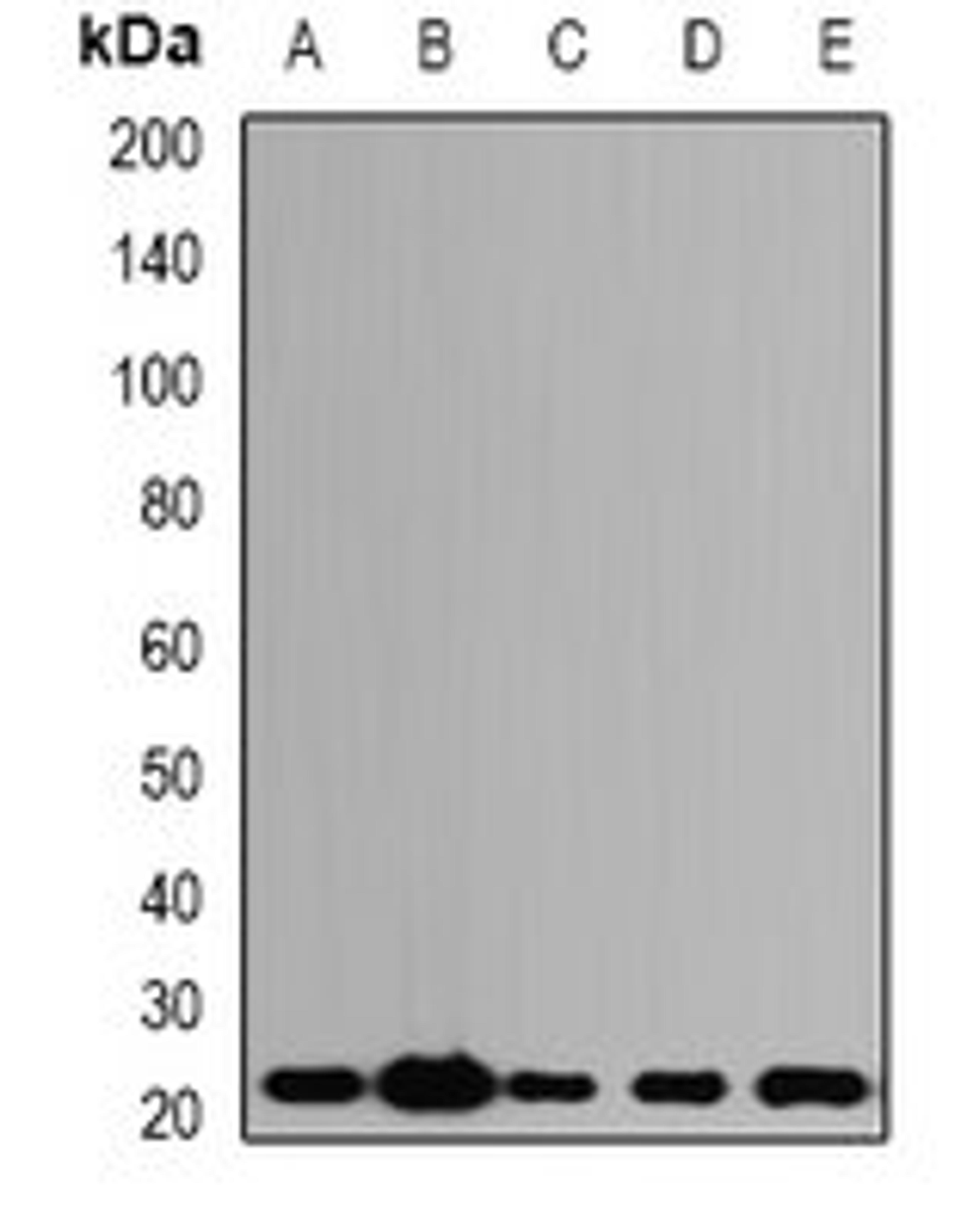 Western blot analysis of SW620 (Lane1), HepG2 (Lane2), mouse kidney (Lane3), mouse lung (Lane4), rat ovary (Lane5) whole cell lysates using PDCD6 antibody