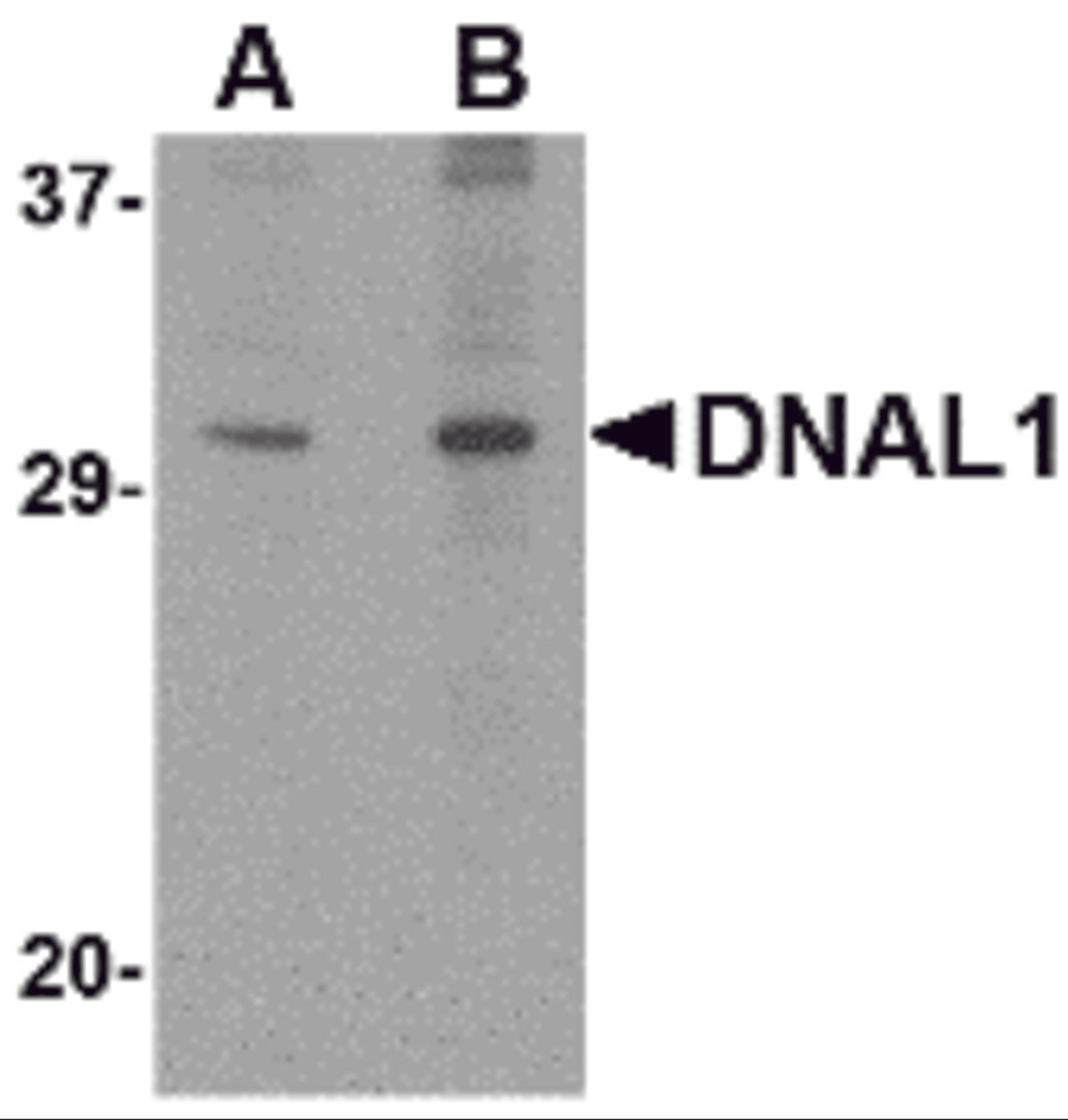 Western blot analysis of DNAL1 in 3T3 cell lysate with DNAL1 antibody at (A) 1 and (B) 2 &#956;g/mL.