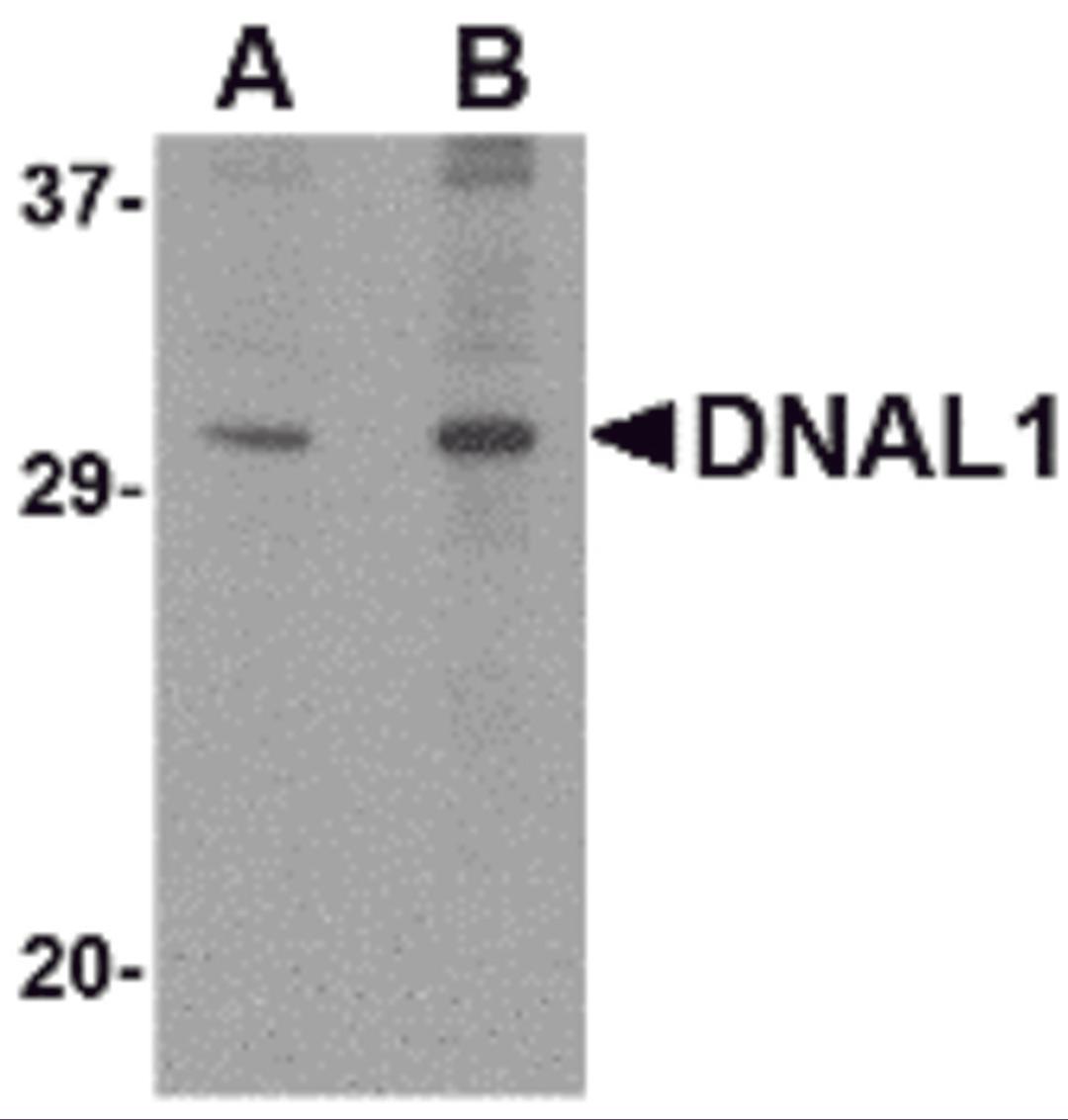 Western blot analysis of DNAL1 in 3T3 cell lysate with DNAL1 antibody at (A) 1 and (B) 2 μg/mL.