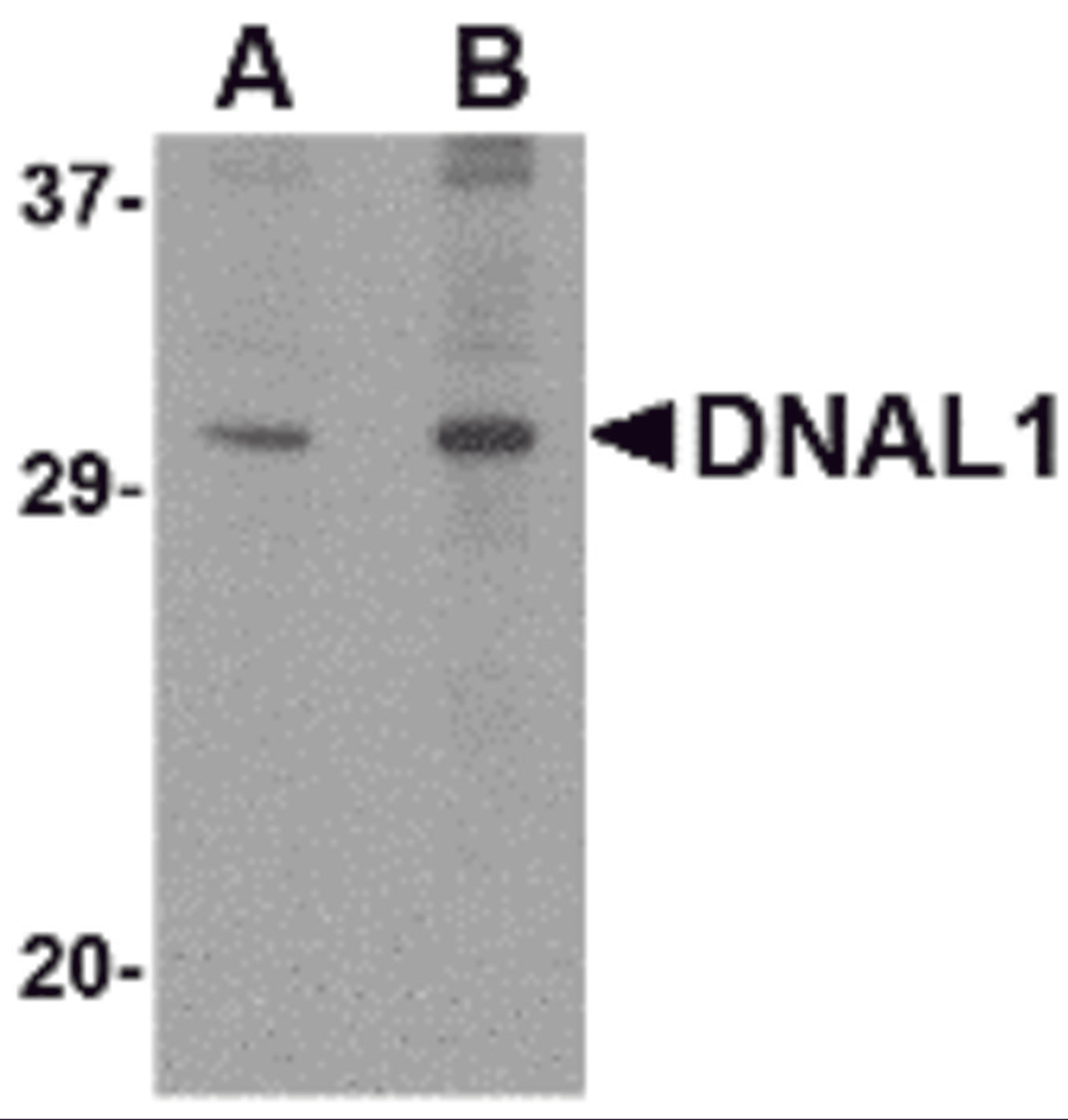 Western blot analysis of DNAL1 in 3T3 cell lysate with DNAL1 antibody at (A) 1 and (B) 2 μg/mL.