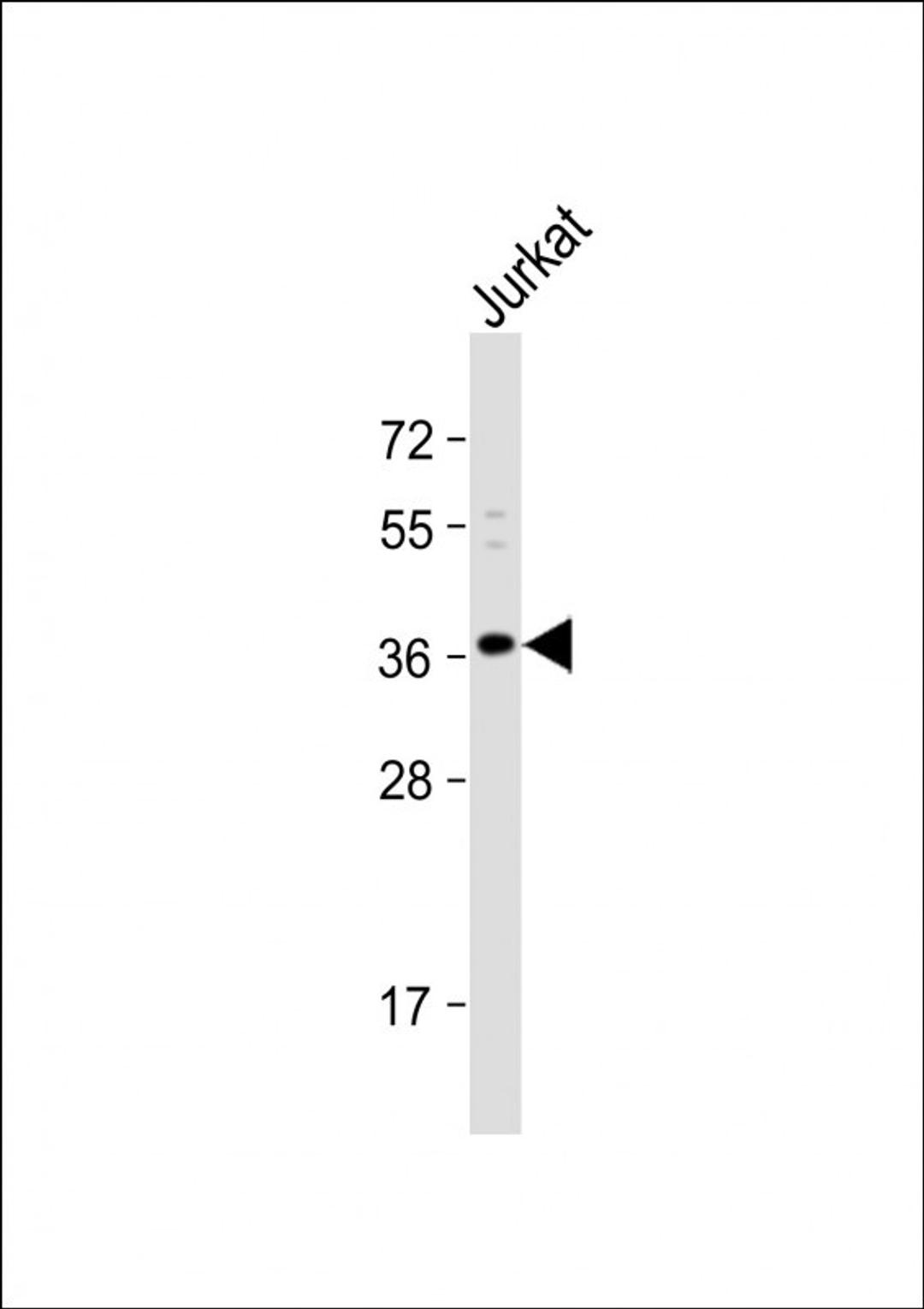 Western Blot at 1:1000 dilution + Jurkat whole cell lysate Lysates/proteins at 20 ug per lane.