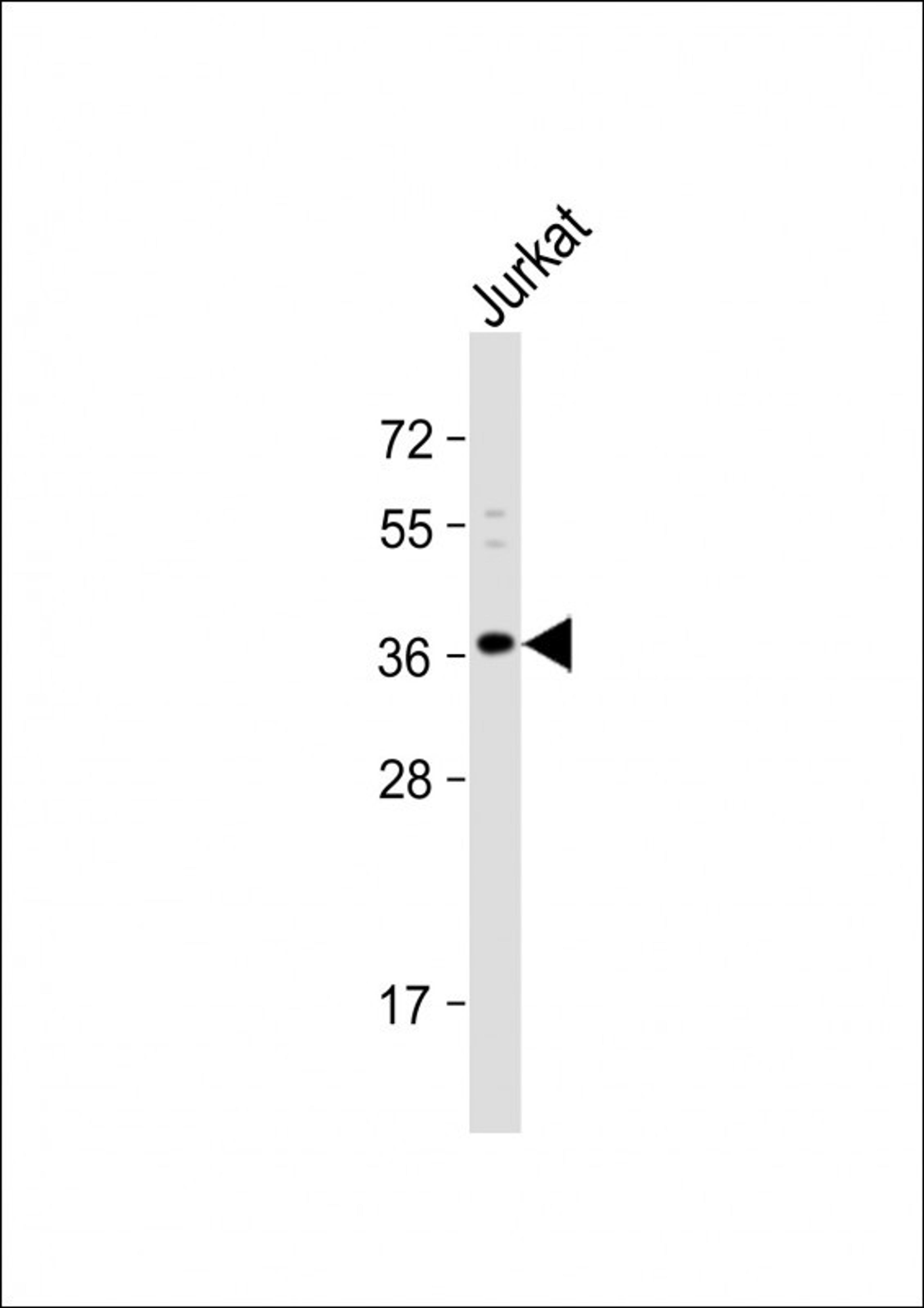 Western Blot at 1:1000 dilution + Jurkat whole cell lysate Lysates/proteins at 20 ug per lane.