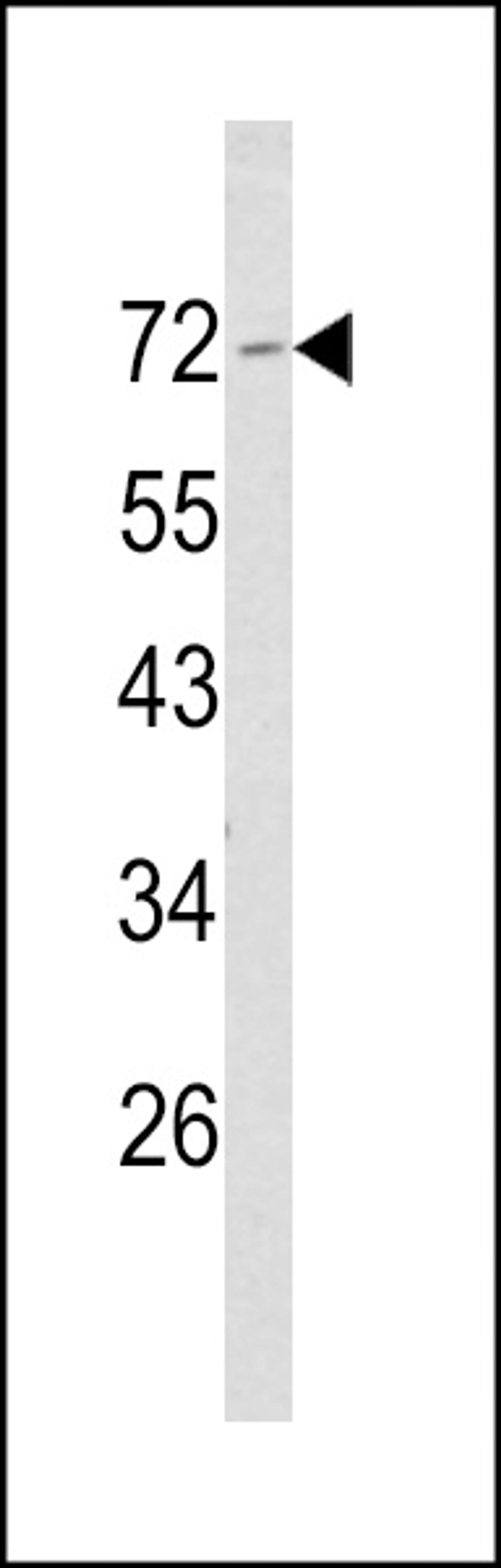 Western blot analysis of Merlin Antibody in NCI-H460 cell line lysates (35ug/lane)